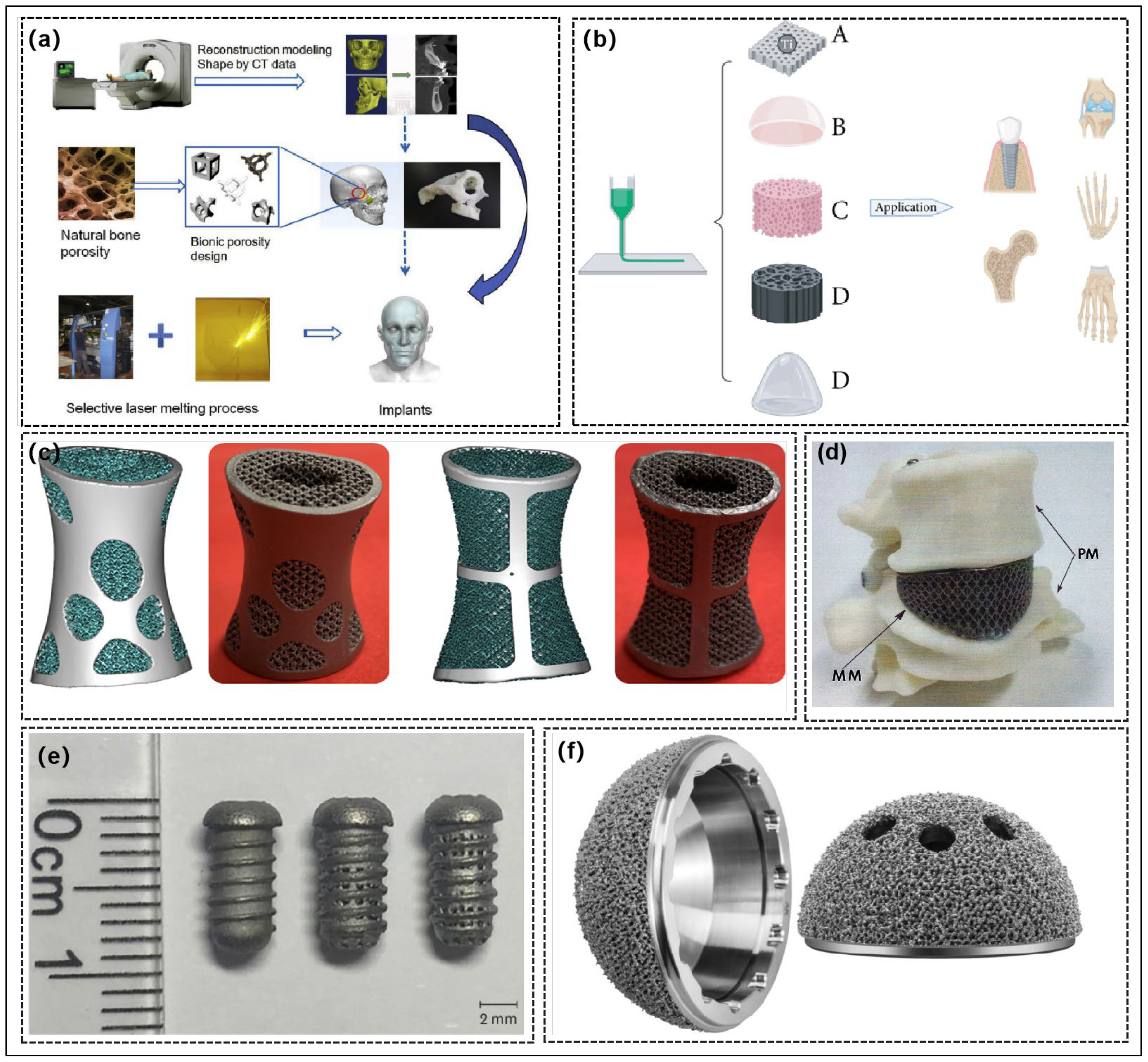 Shoulers, Bi, and Tri – click to view and print this illustrated