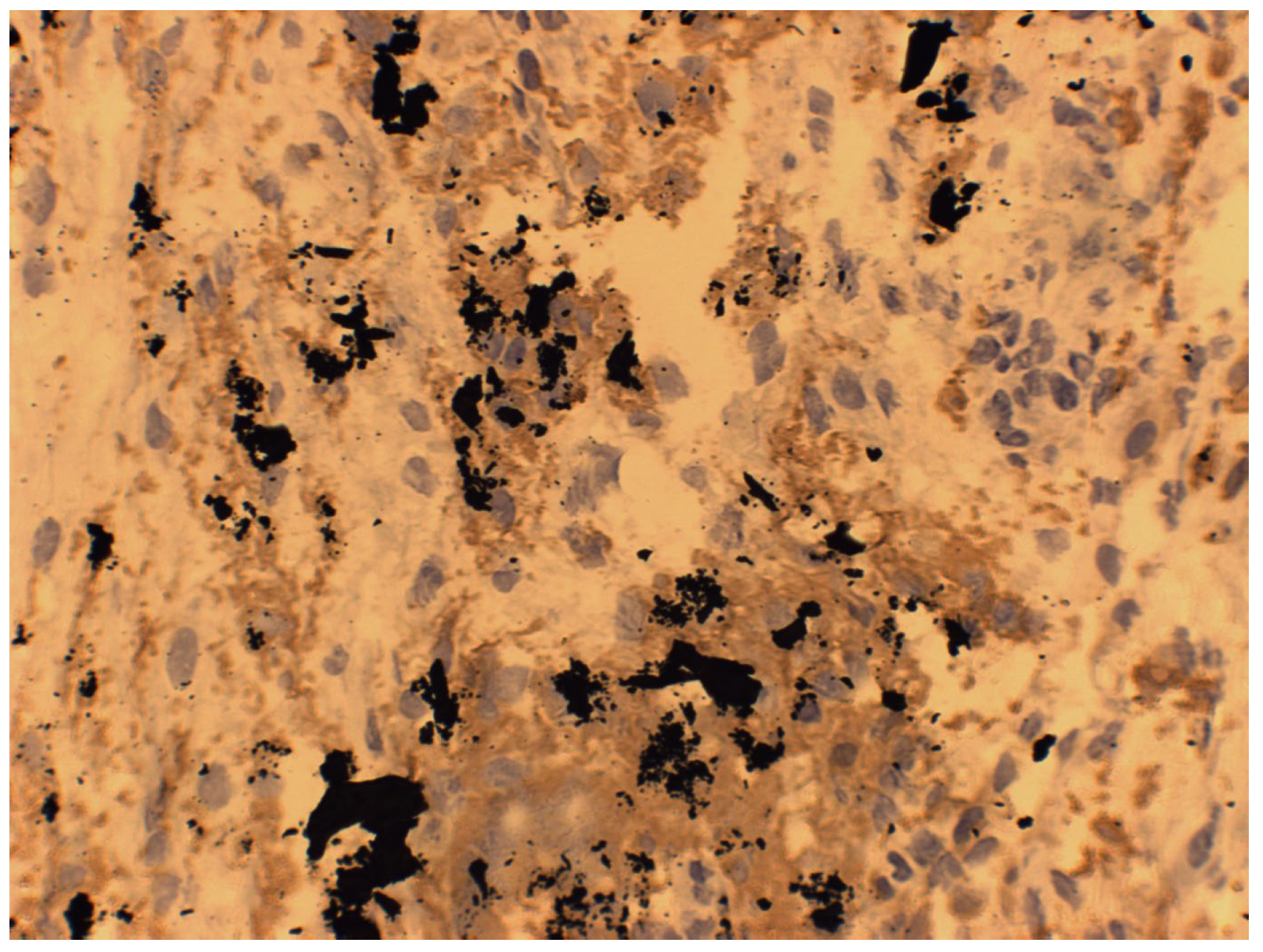 Coatings 15 00361 g002