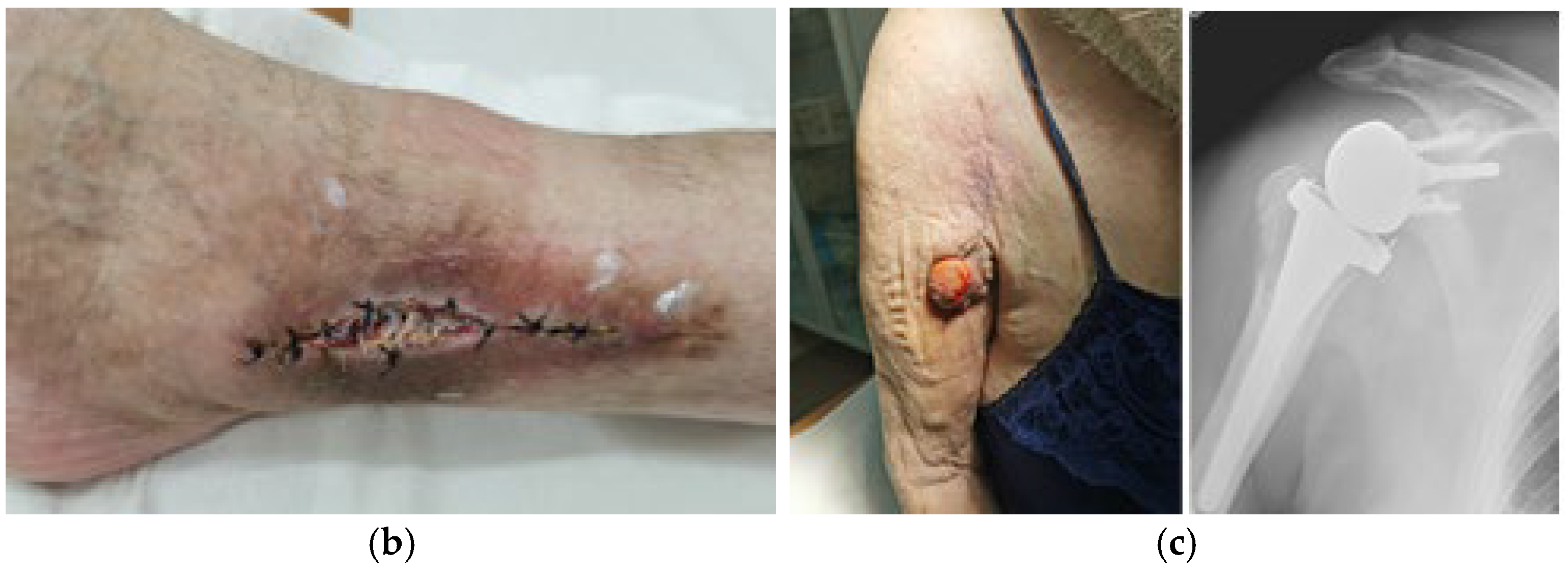 Coatings 15 00361 g003b