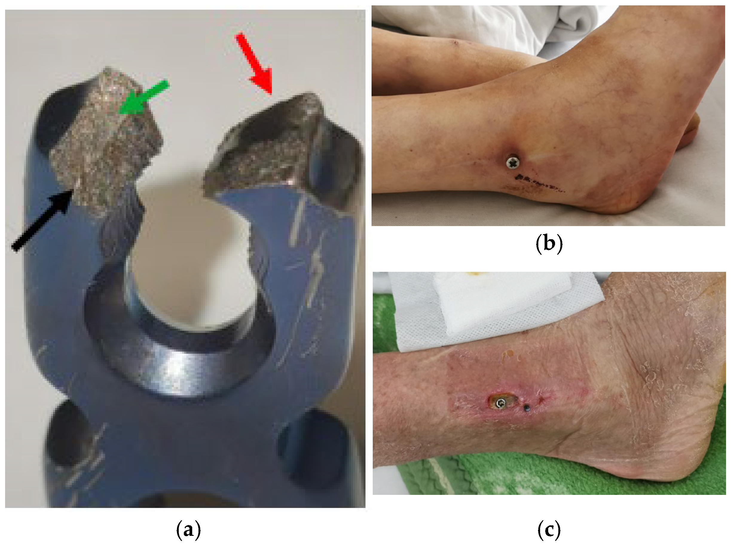 Coatings 15 00361 g006