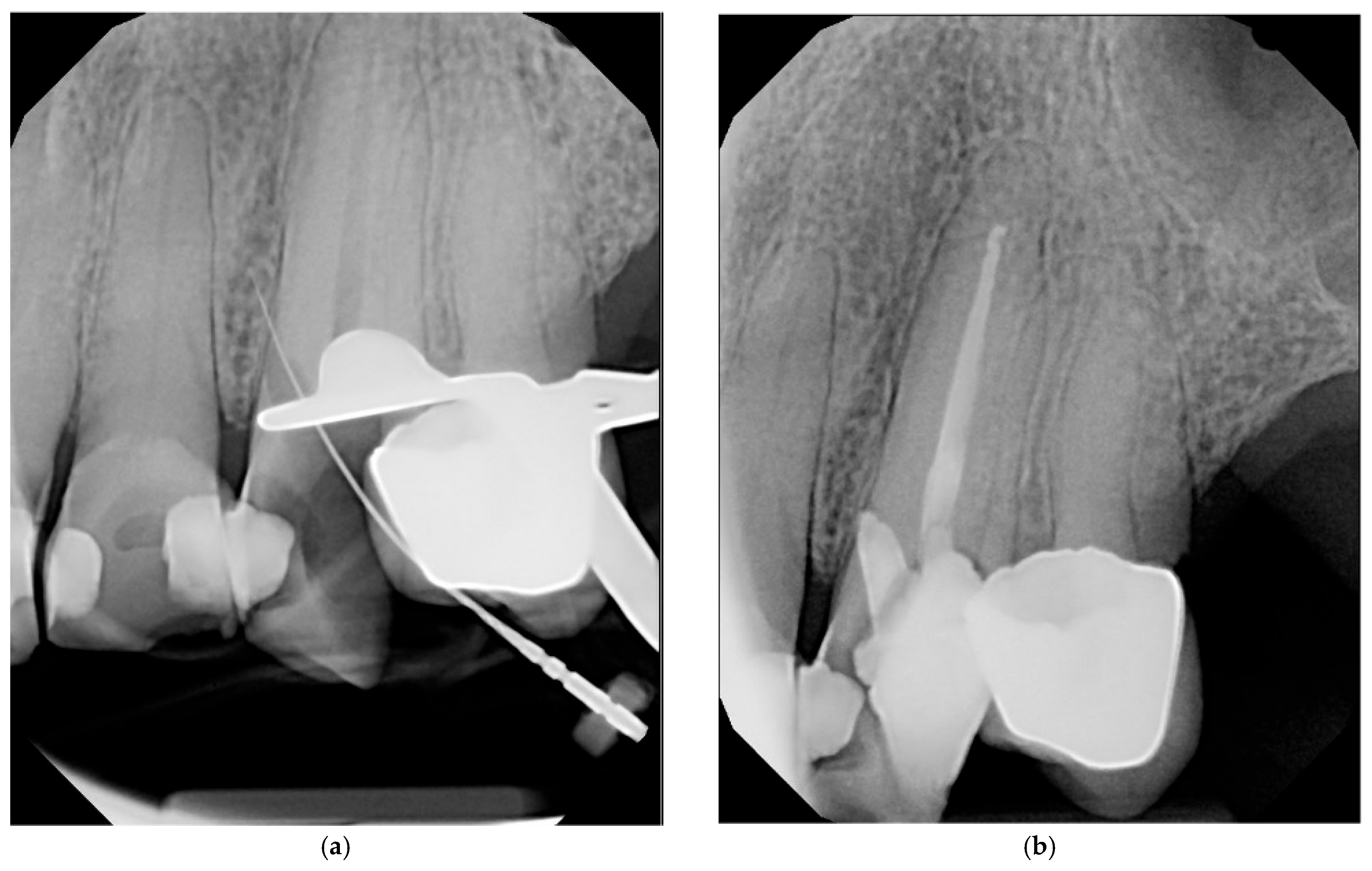 Complications 02 00017 g003