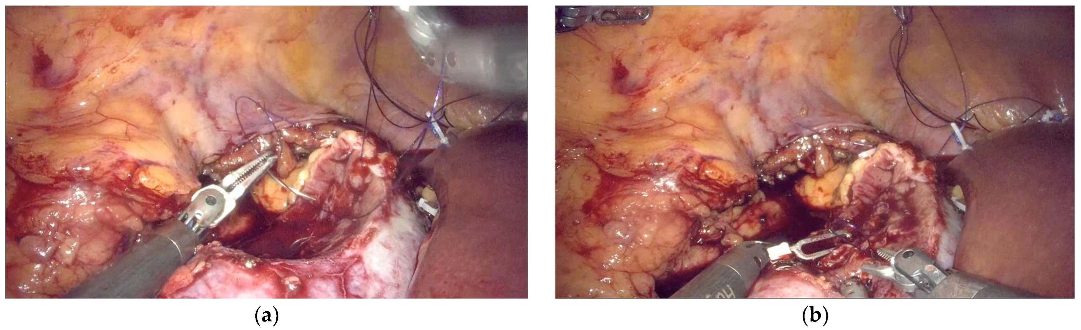 Complications 02 00021 g001a Complications 02 00021 g001a