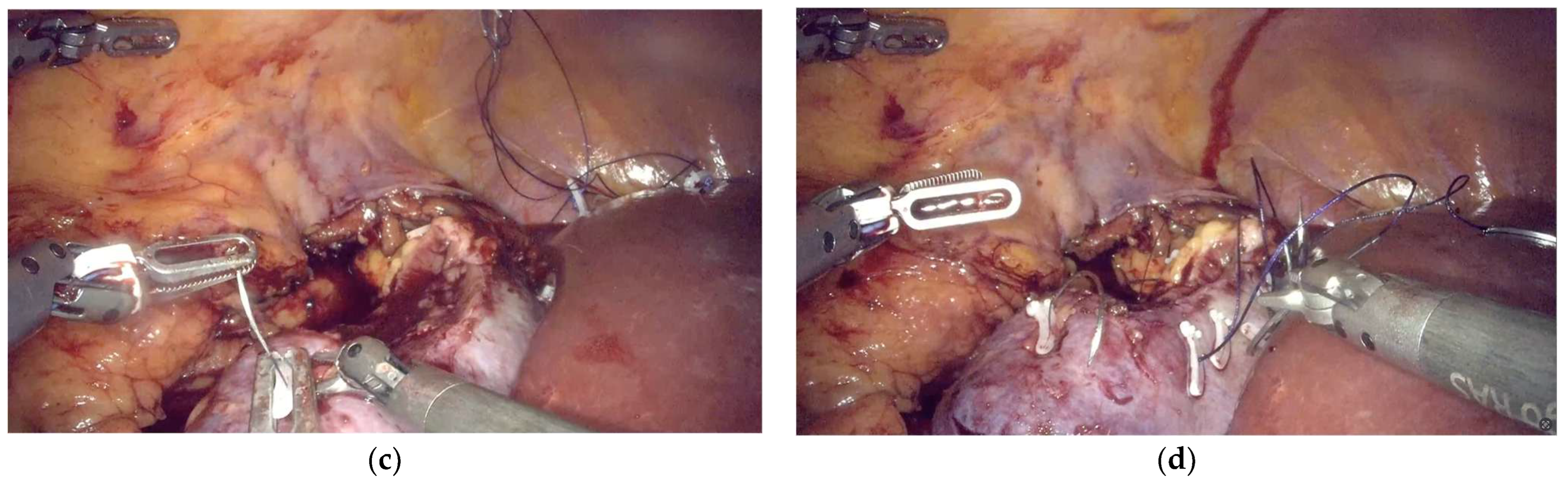 Complications 02 00021 g001b Complications 02 00021 g001b