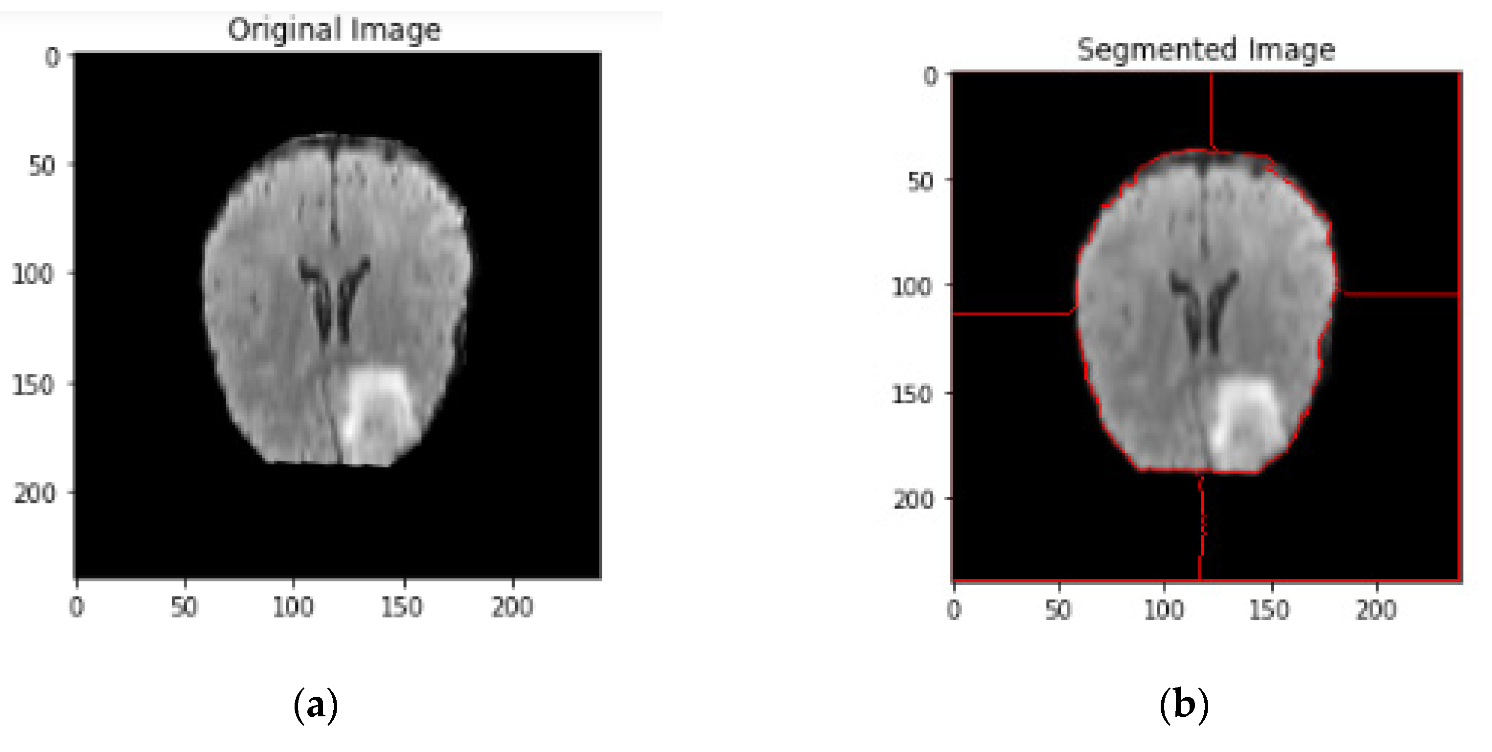 PDF] Brain Tumor Segmentation of MRI Images Using Processed Image Driven  U-Net Architecture