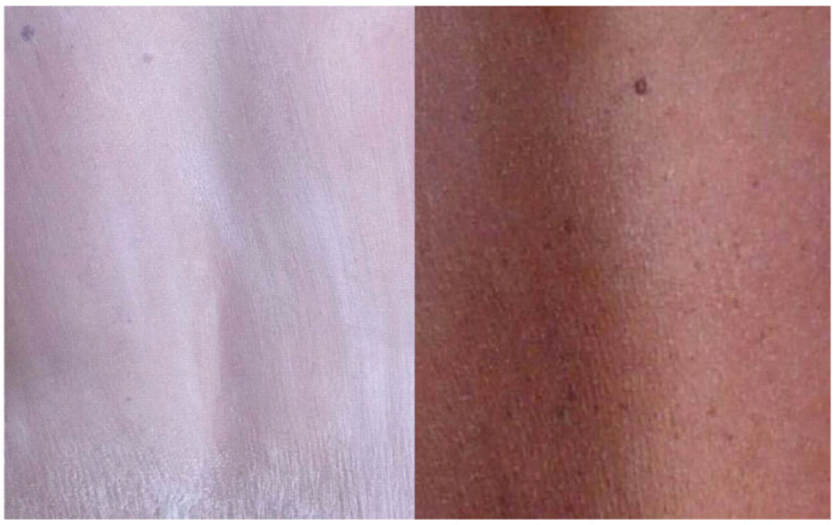 Cosmetics 02 00177 g003