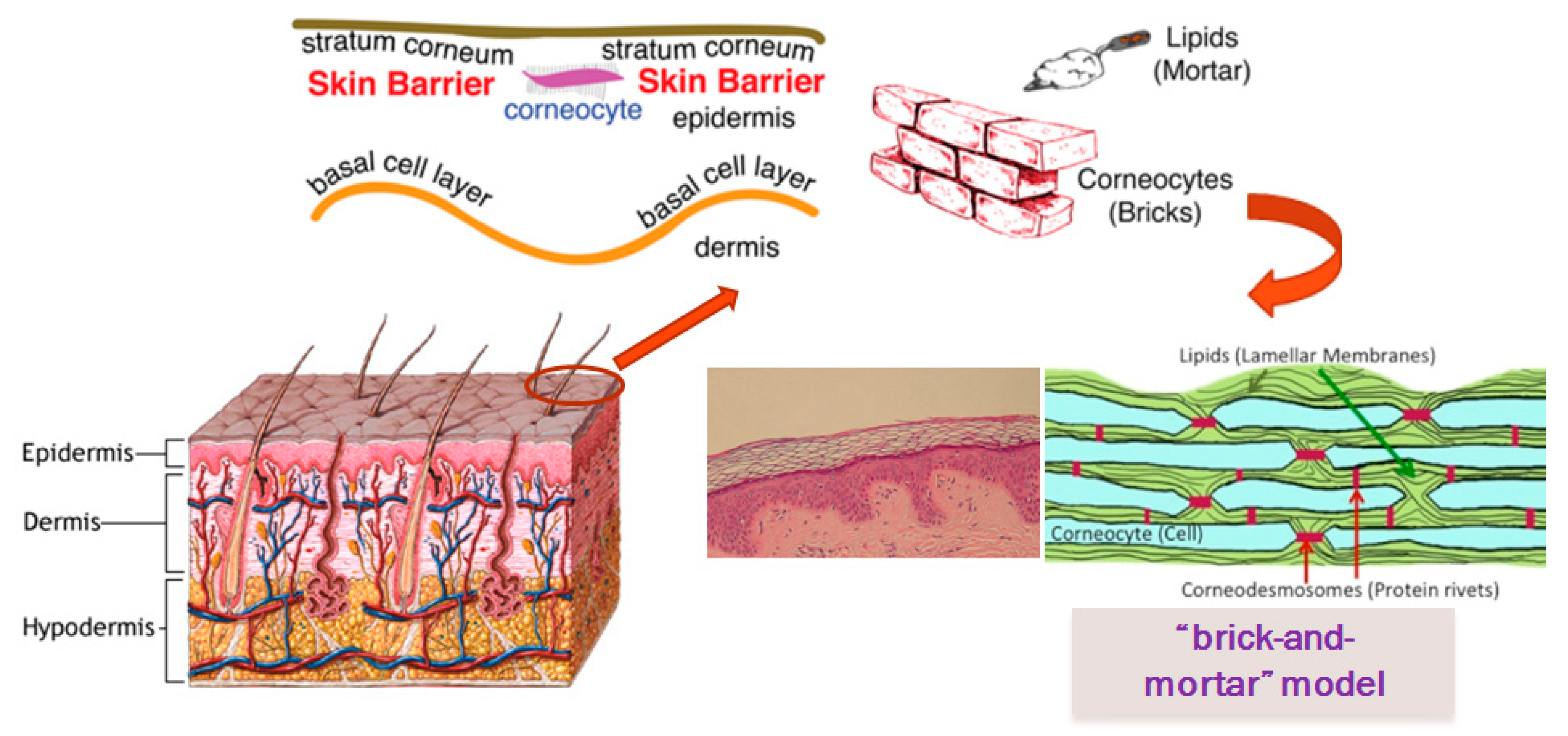 Cosmetics | Free Full-Text | Recent Advances on Topical Application of  Ceramides to Restore Barrier Function of Skin
