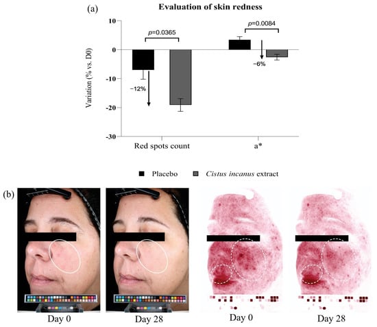 Cosmetics | Free Full-Text | A Cistus incanus Extract Blocks Psychological  Stress Signaling and Reduces Neurogenic Inflammation and Signs of Aging in  Skin, as Shown in In-Vitro Models and a Randomized Clinical