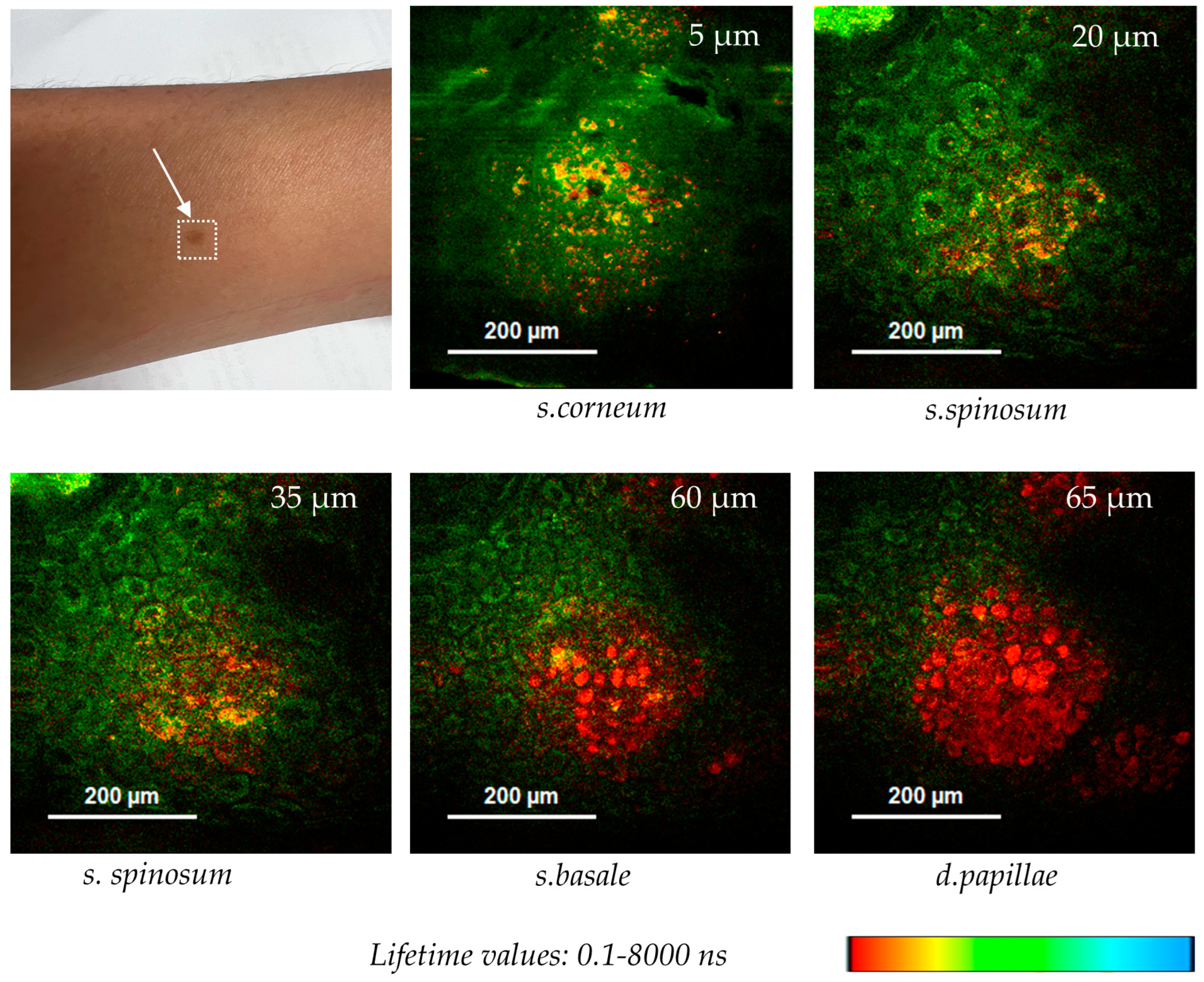 Cosmetics 12 00044 g011