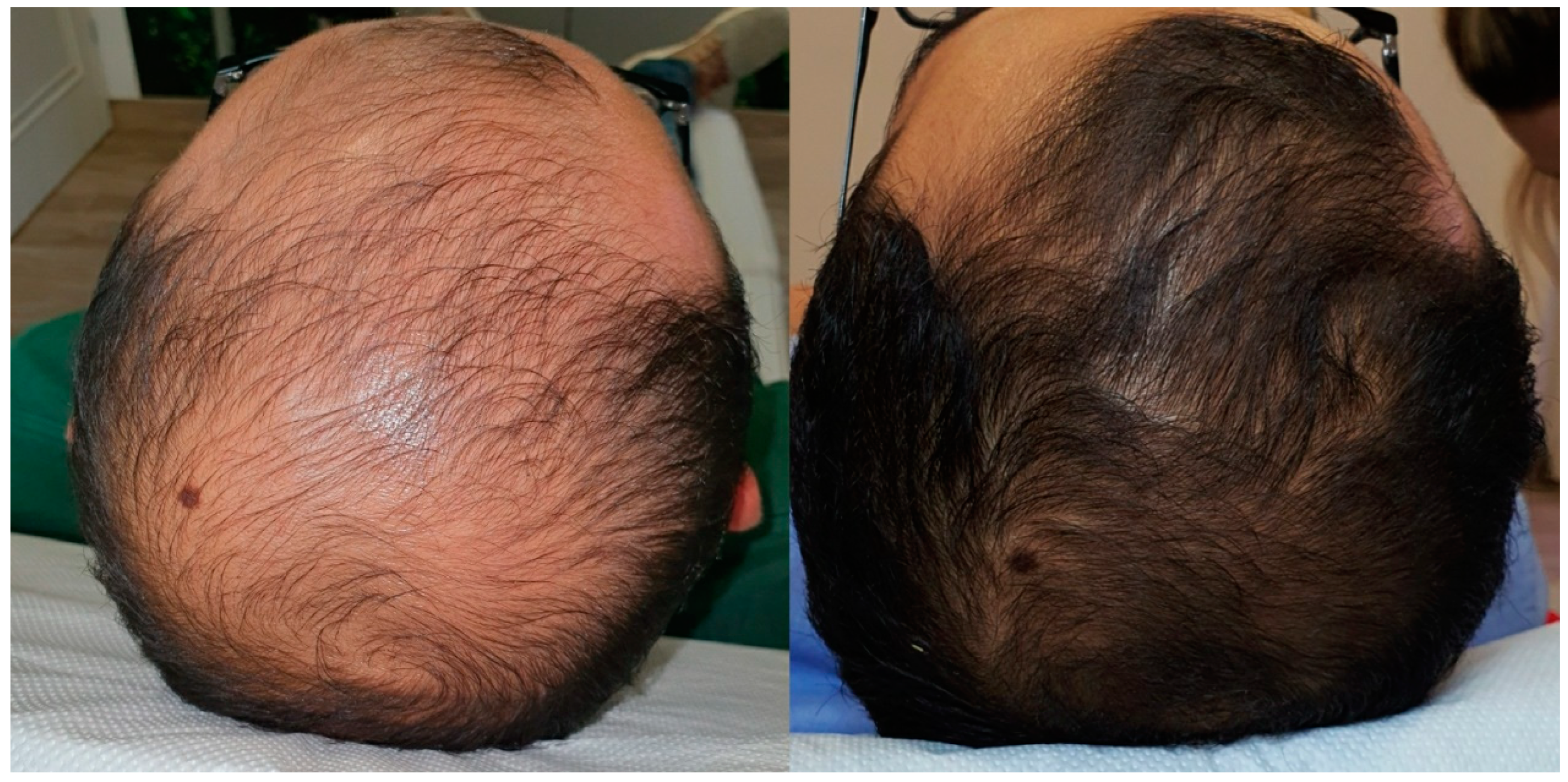 Cosmetics 12 00046 g010