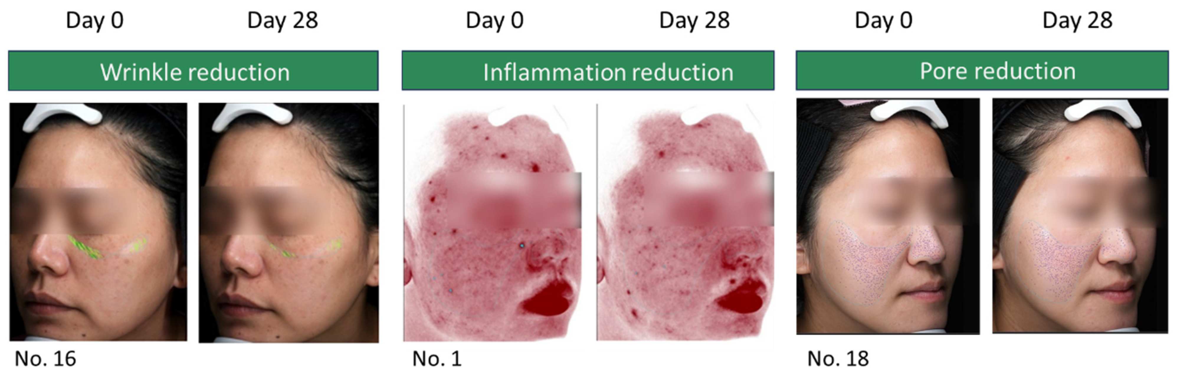 Cosmetics 12 00186 g004 Cosmetics 12 00186 g004