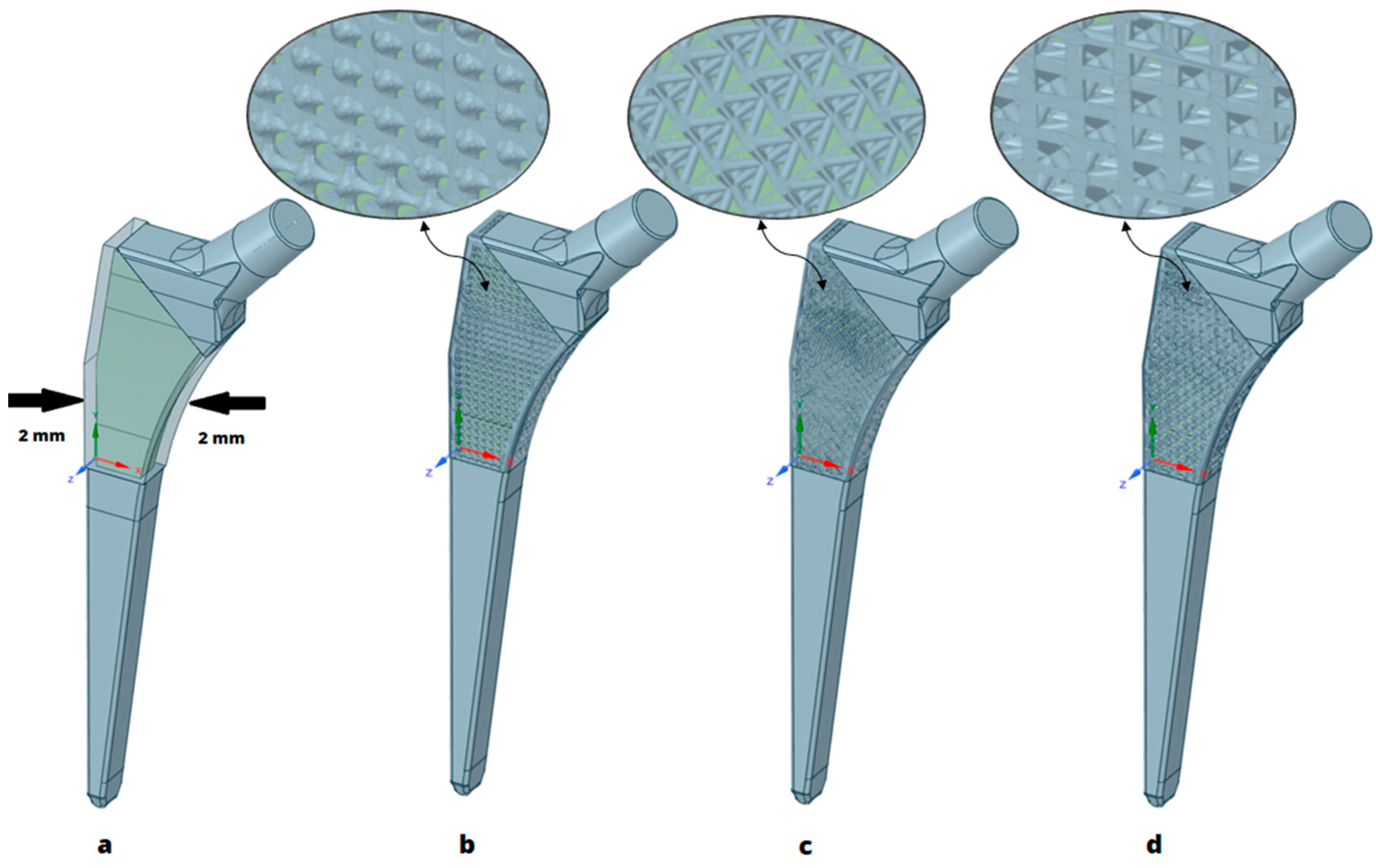 Crystals Free Full Text Optimization Of Additively Manufactured And Lattice Structured Hip 7345