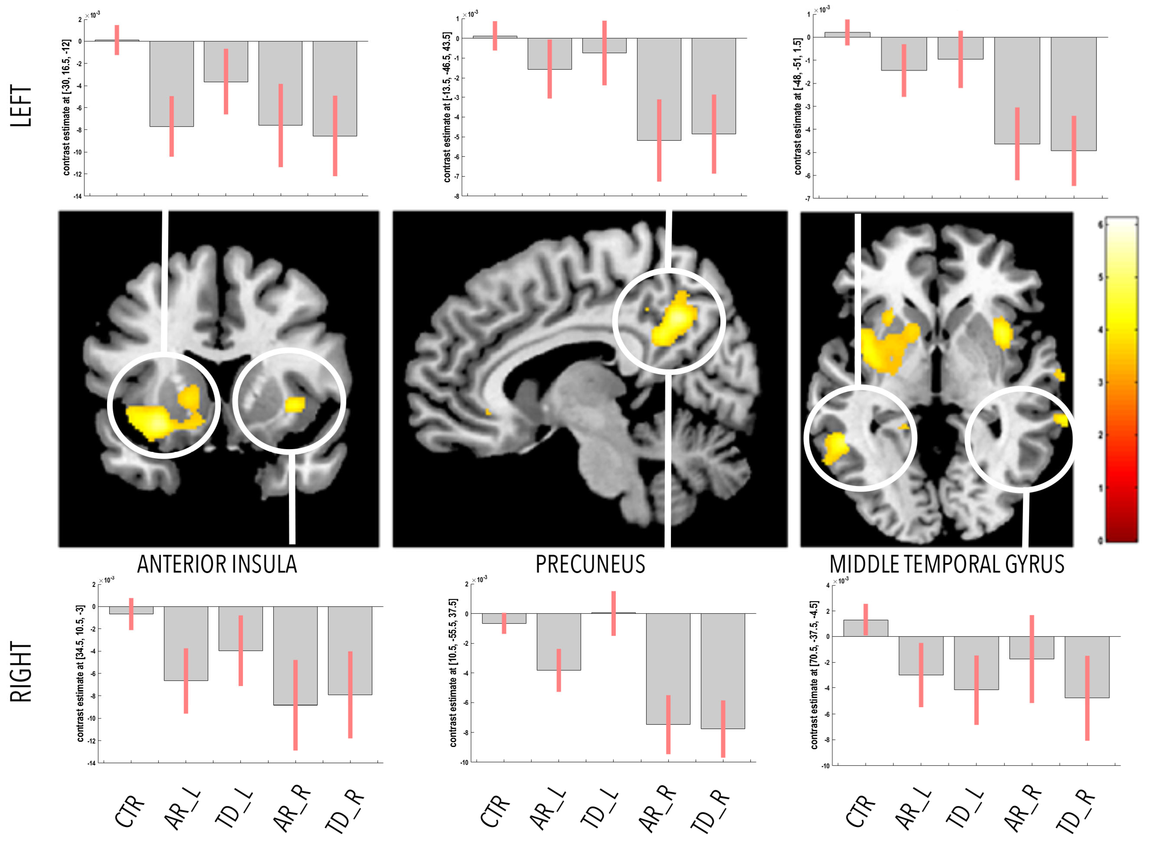 Motor Parkinson's disease and structure (Chapter 3) - Magnetic Resonance  Imaging in Movement Disorders