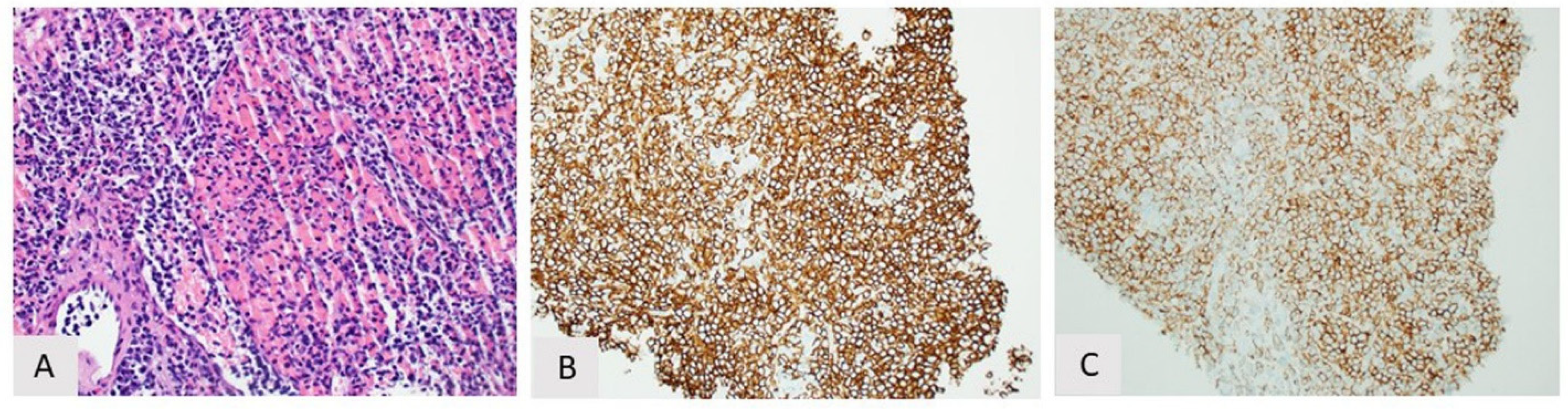 Curroncol 28 00430 g005 Curroncol 28 00430 g005