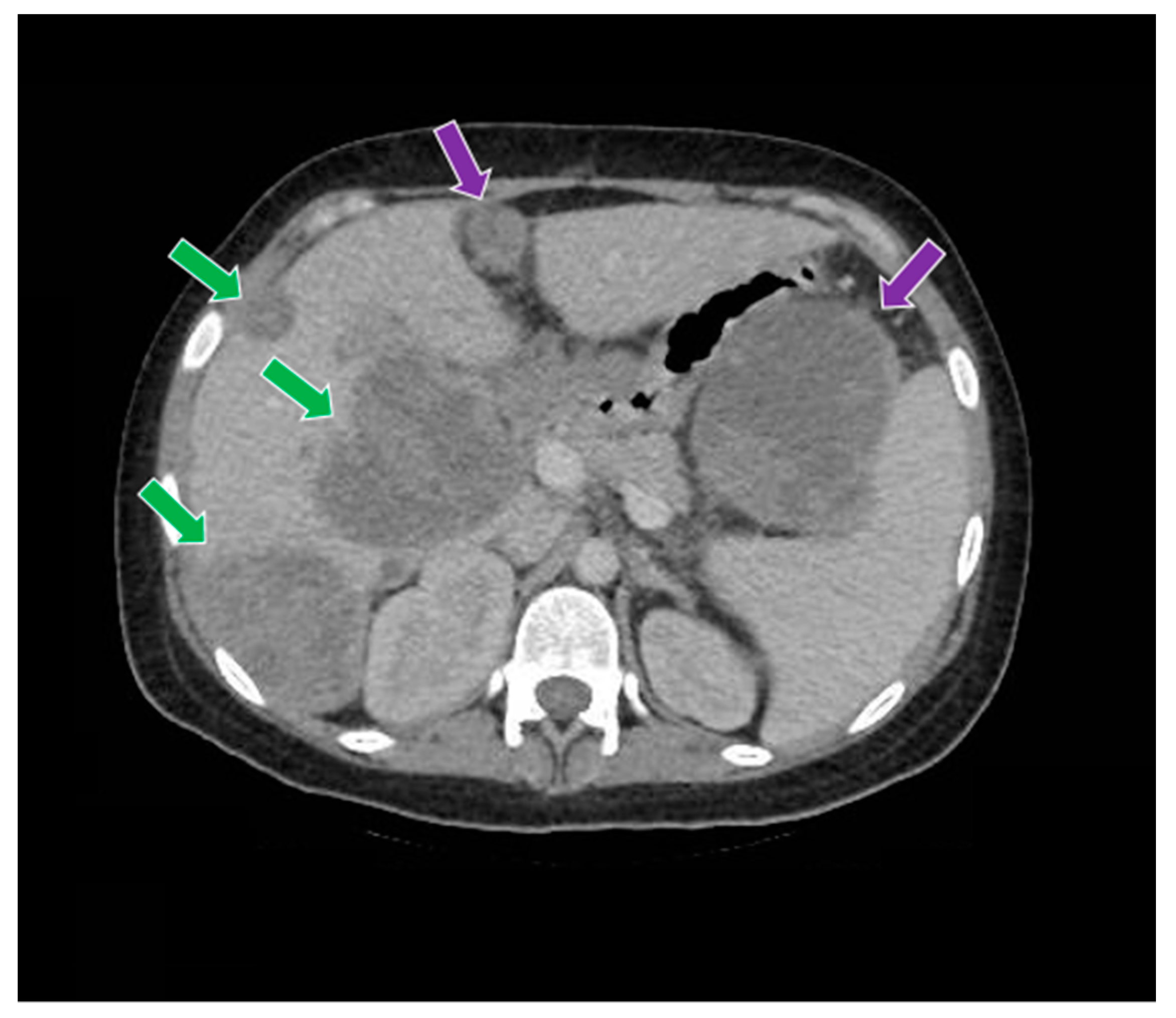 Curroncol 29 00037 g009