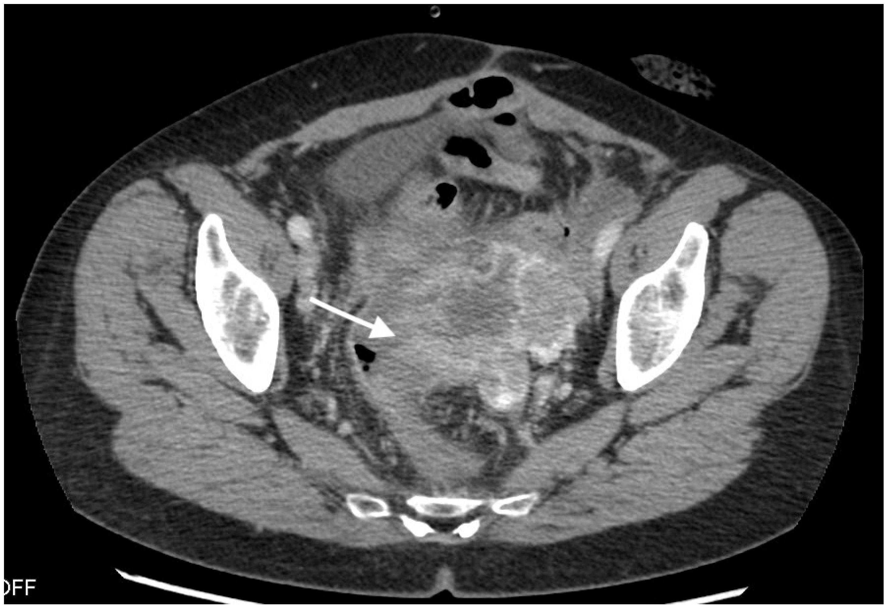 Curroncol 30 00040 g001 Curroncol 30 00040 g001