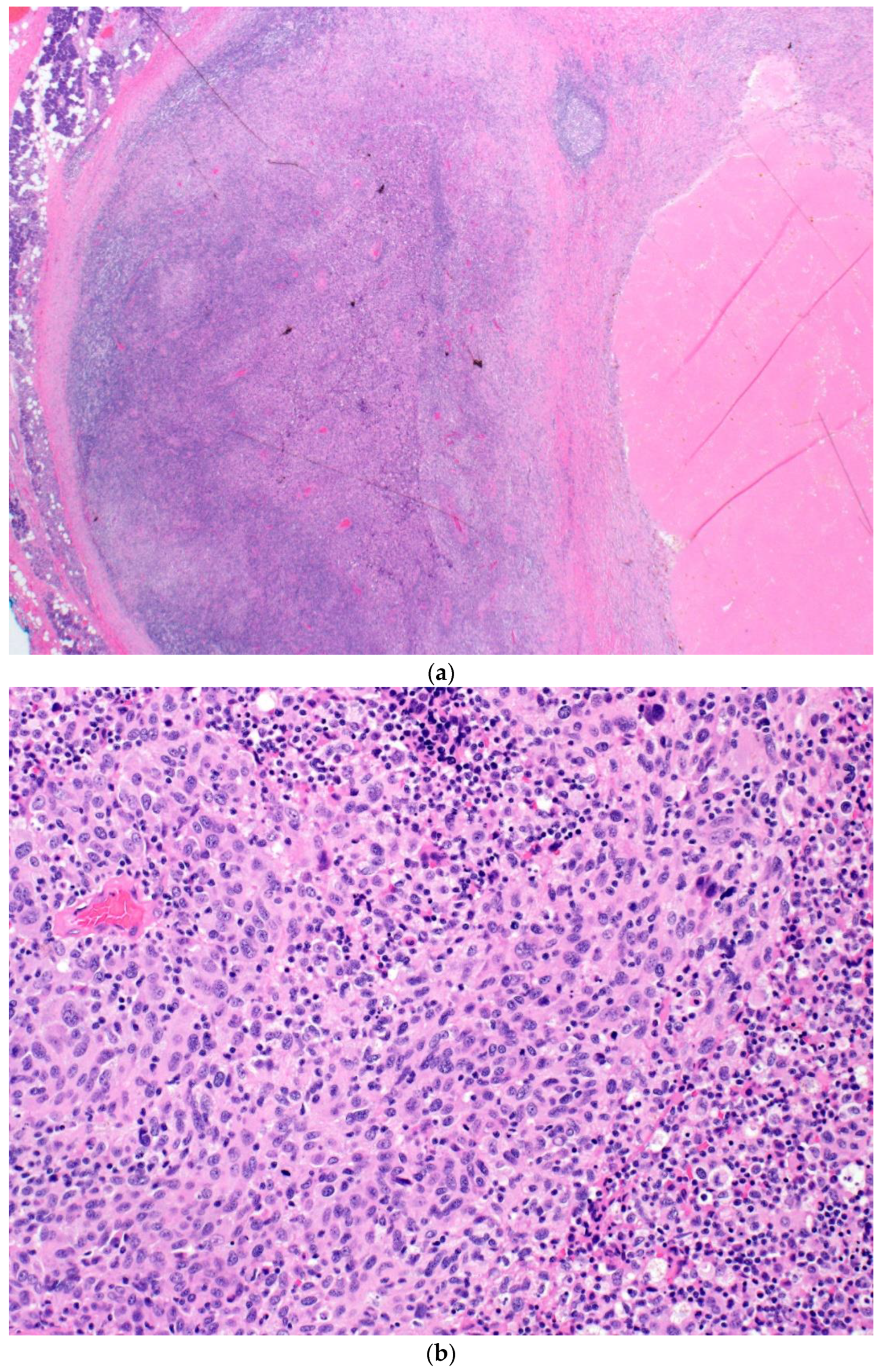 Curroncol 30 00335 g002a Curroncol 30 00335 g002a