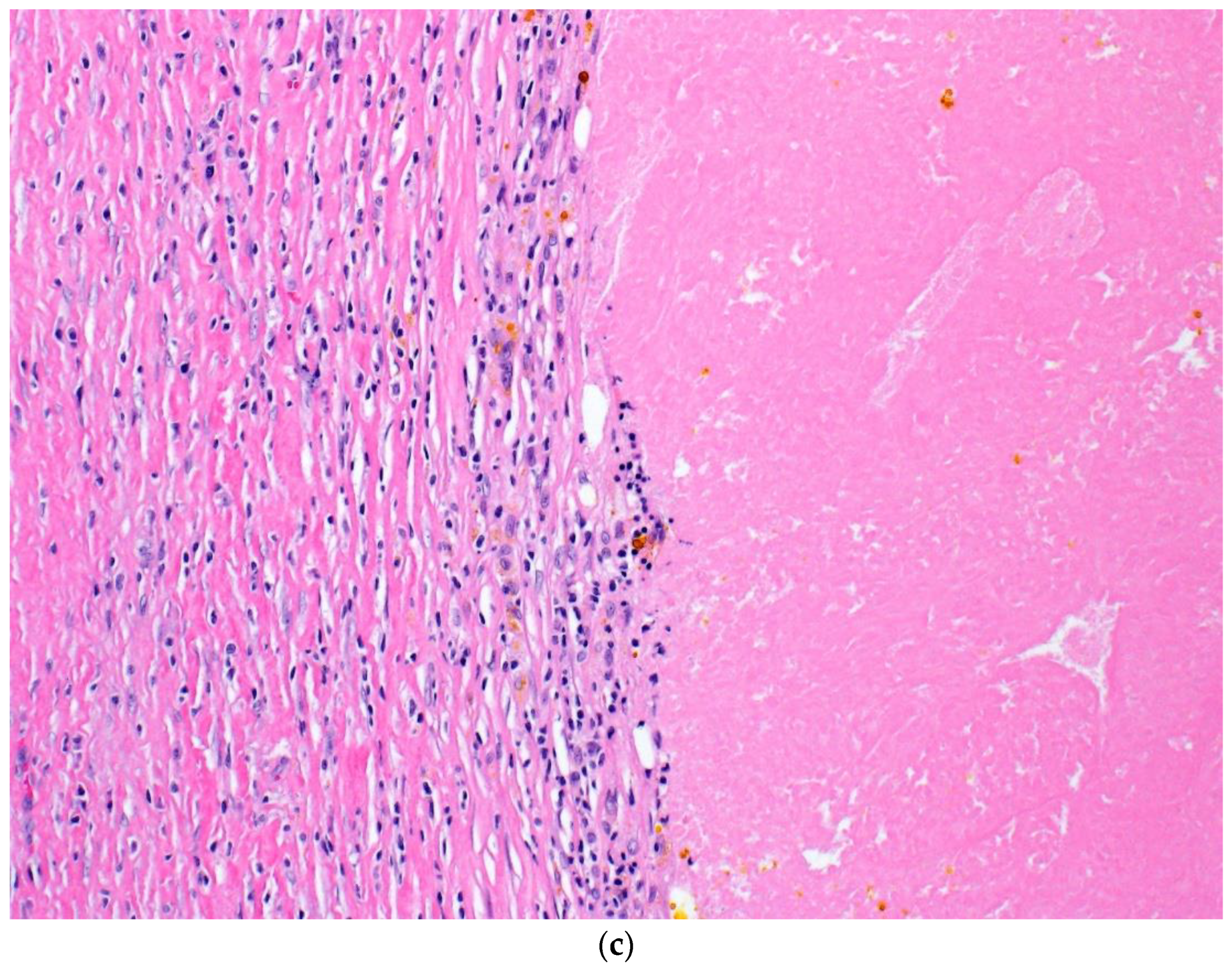 Curroncol 30 00335 g002b Curroncol 30 00335 g002b