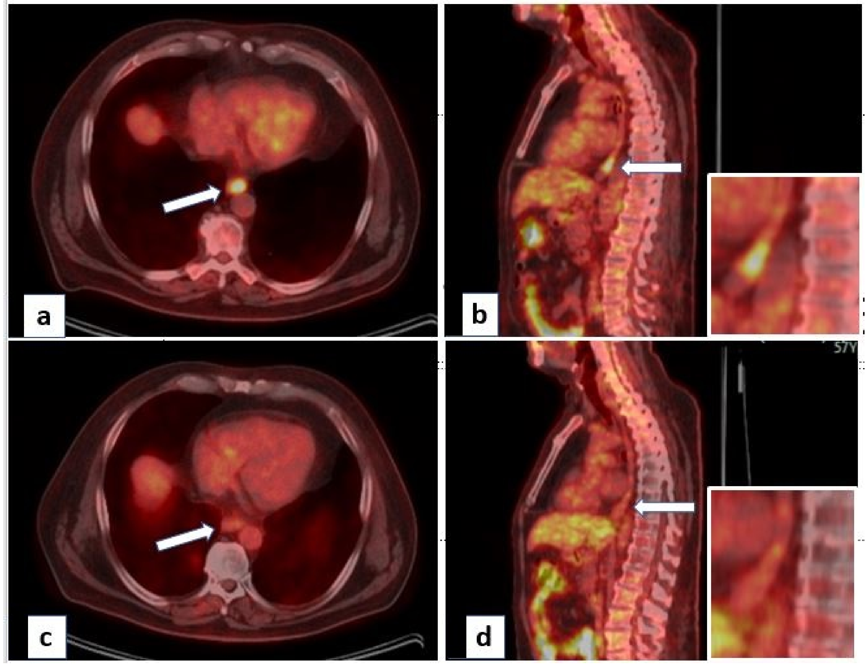 Current Oncology | Free Full-Text | Combination of Immunotherapy