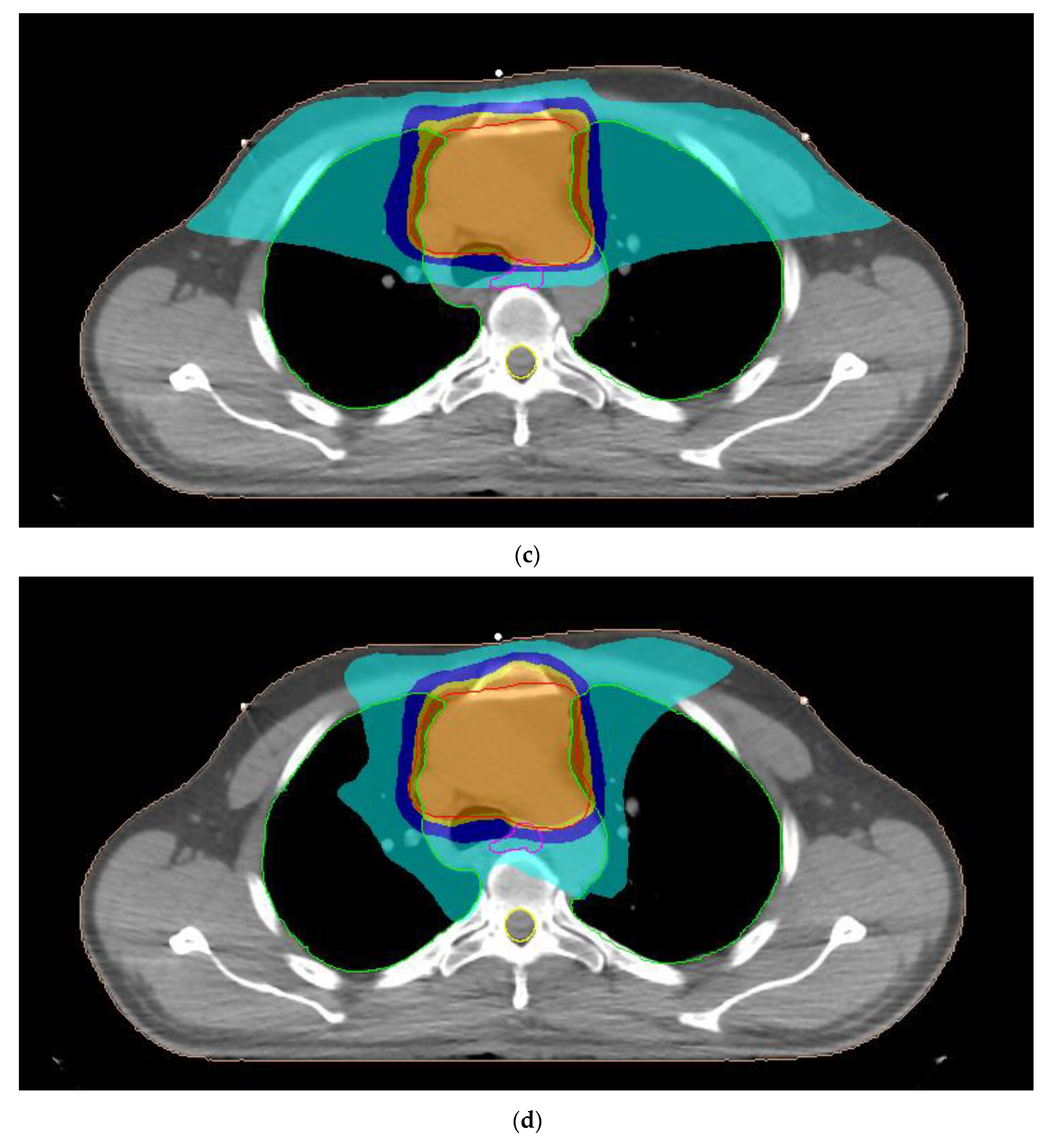 Curroncol 30 00561 g001b