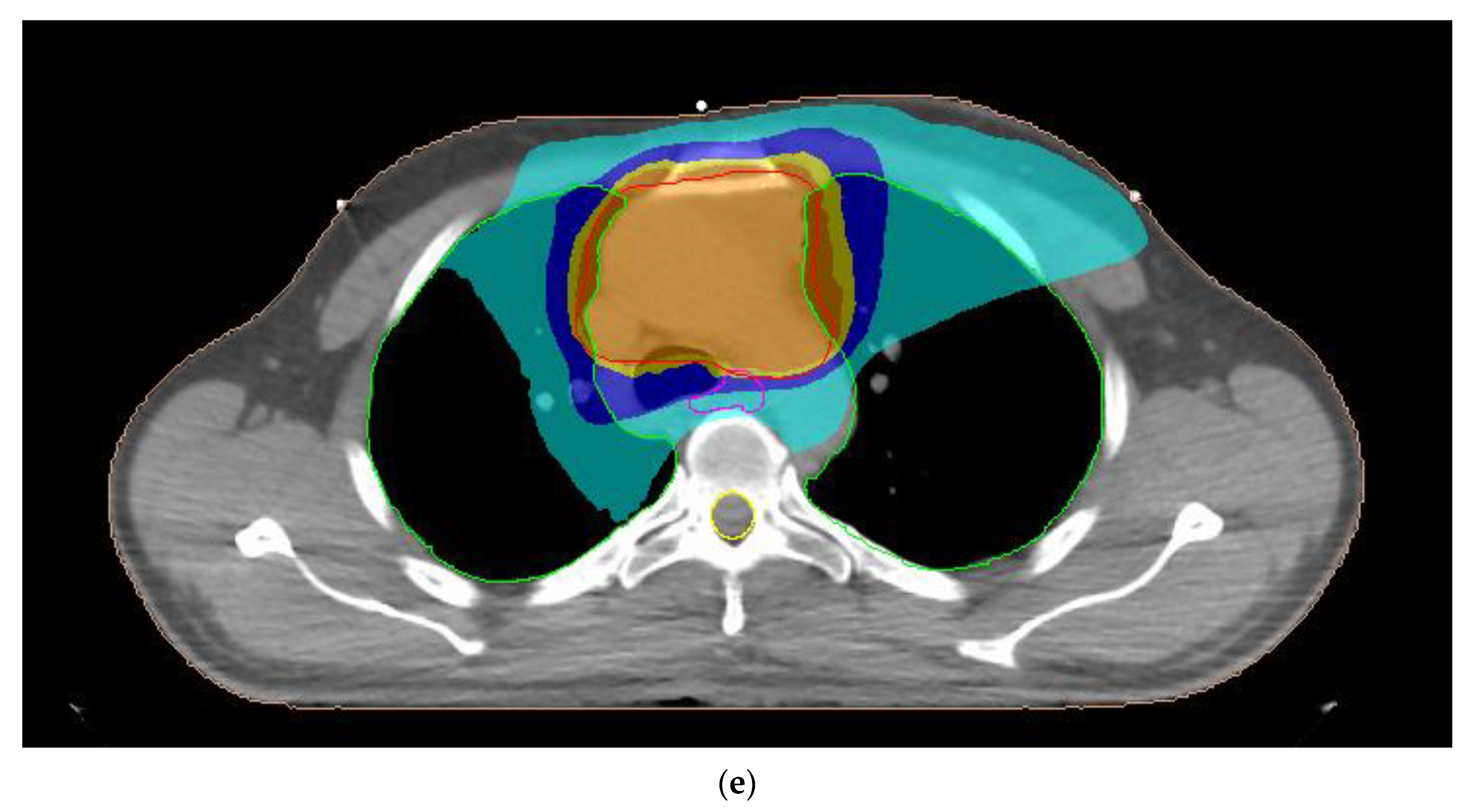 Curroncol 30 00561 g001c