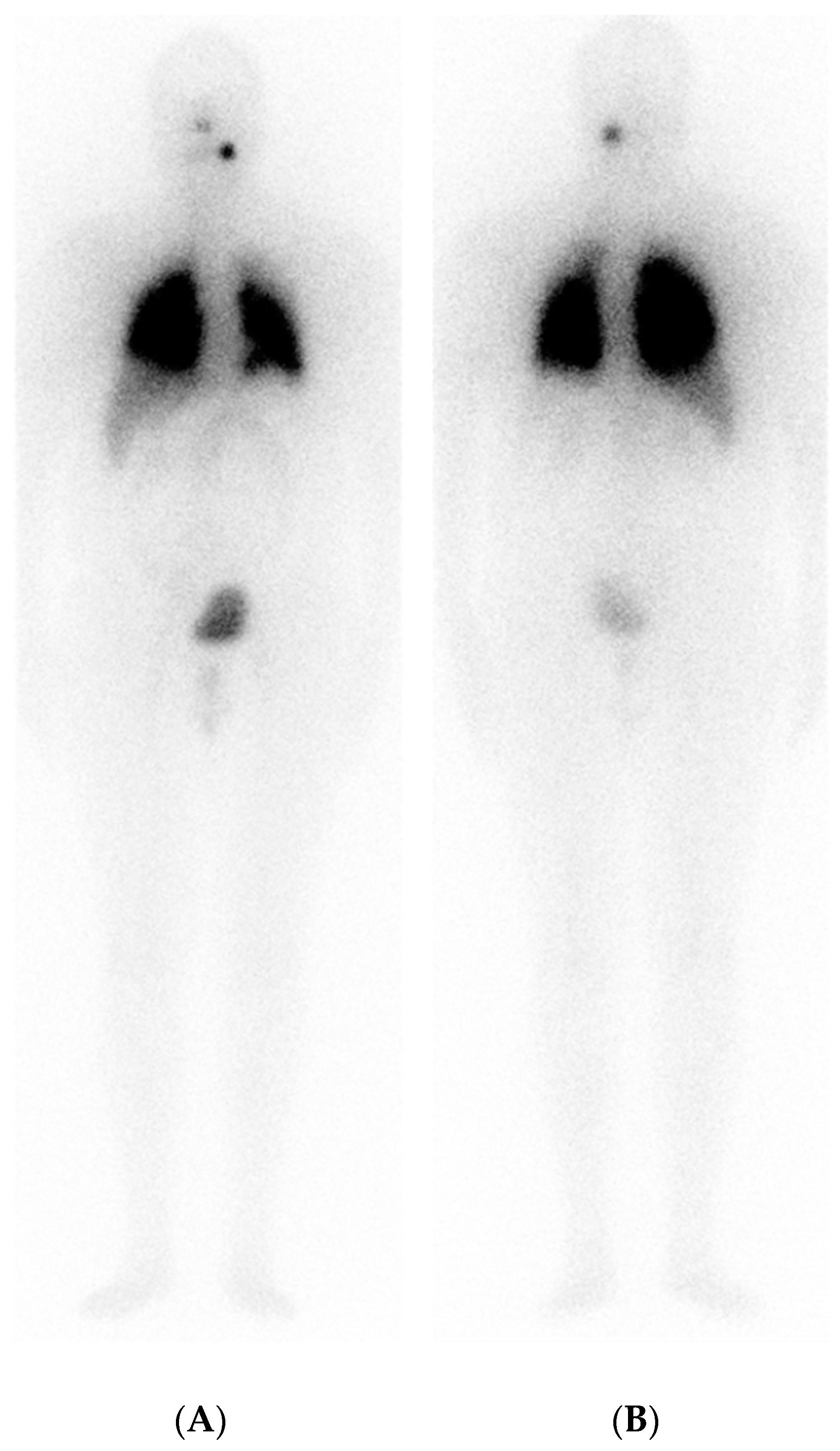 Curroncol 31 00286 g002 Curroncol 31 00286 g002