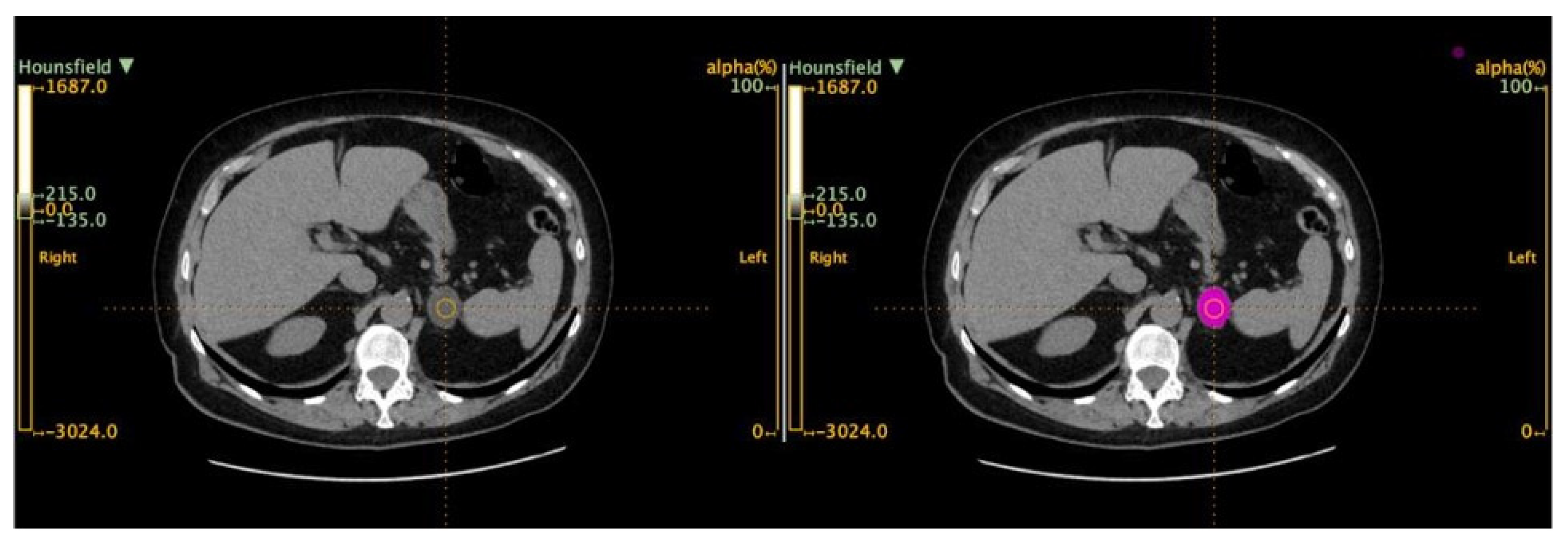 Curroncol 31 00364 g002