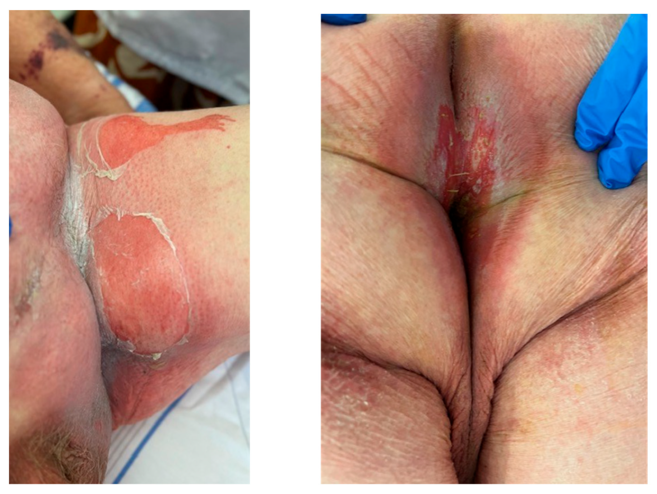 Curroncol 31 00509 g001 Curroncol 31 00509 g001