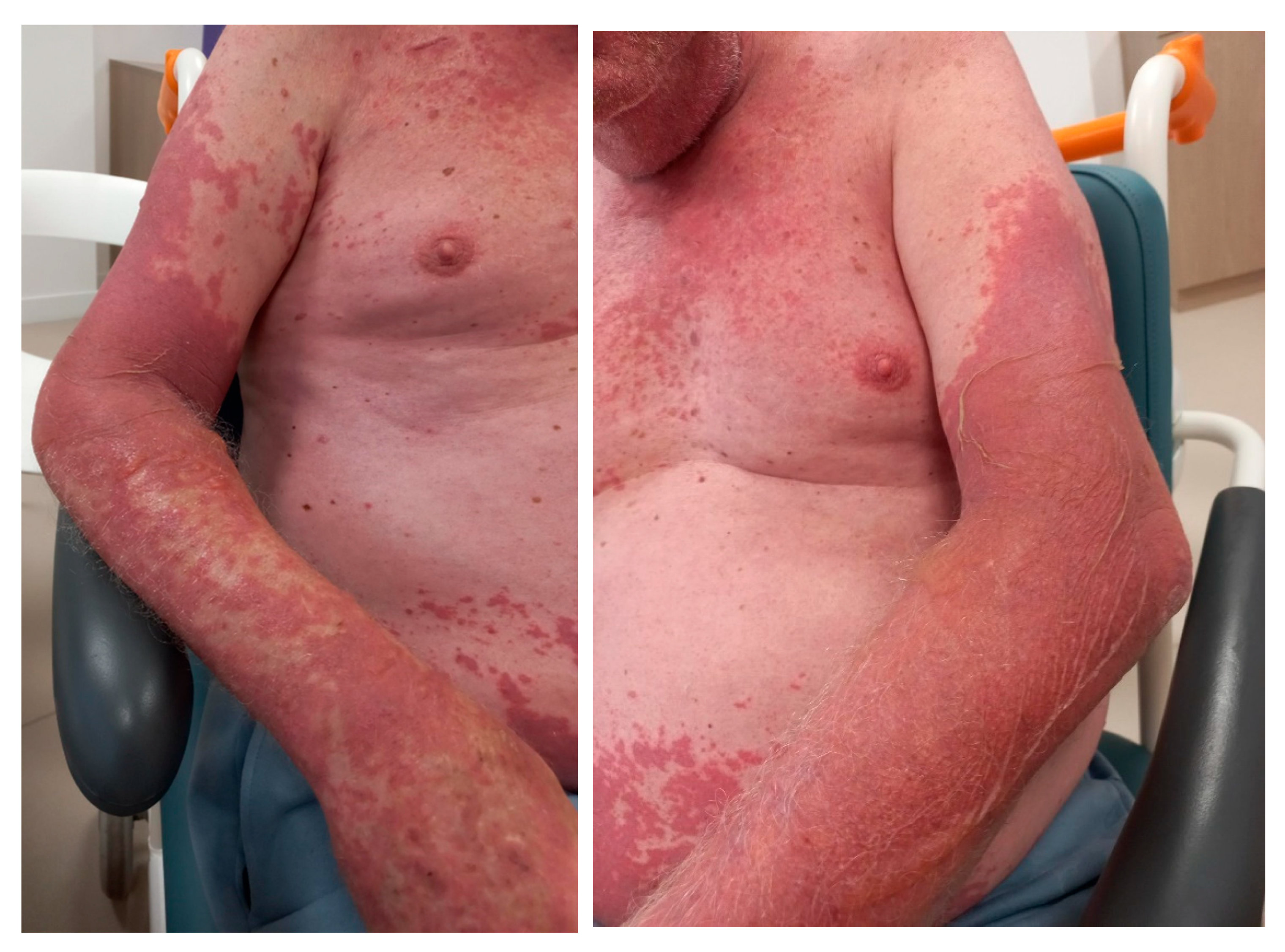 Curroncol 31 00509 g002 Curroncol 31 00509 g002