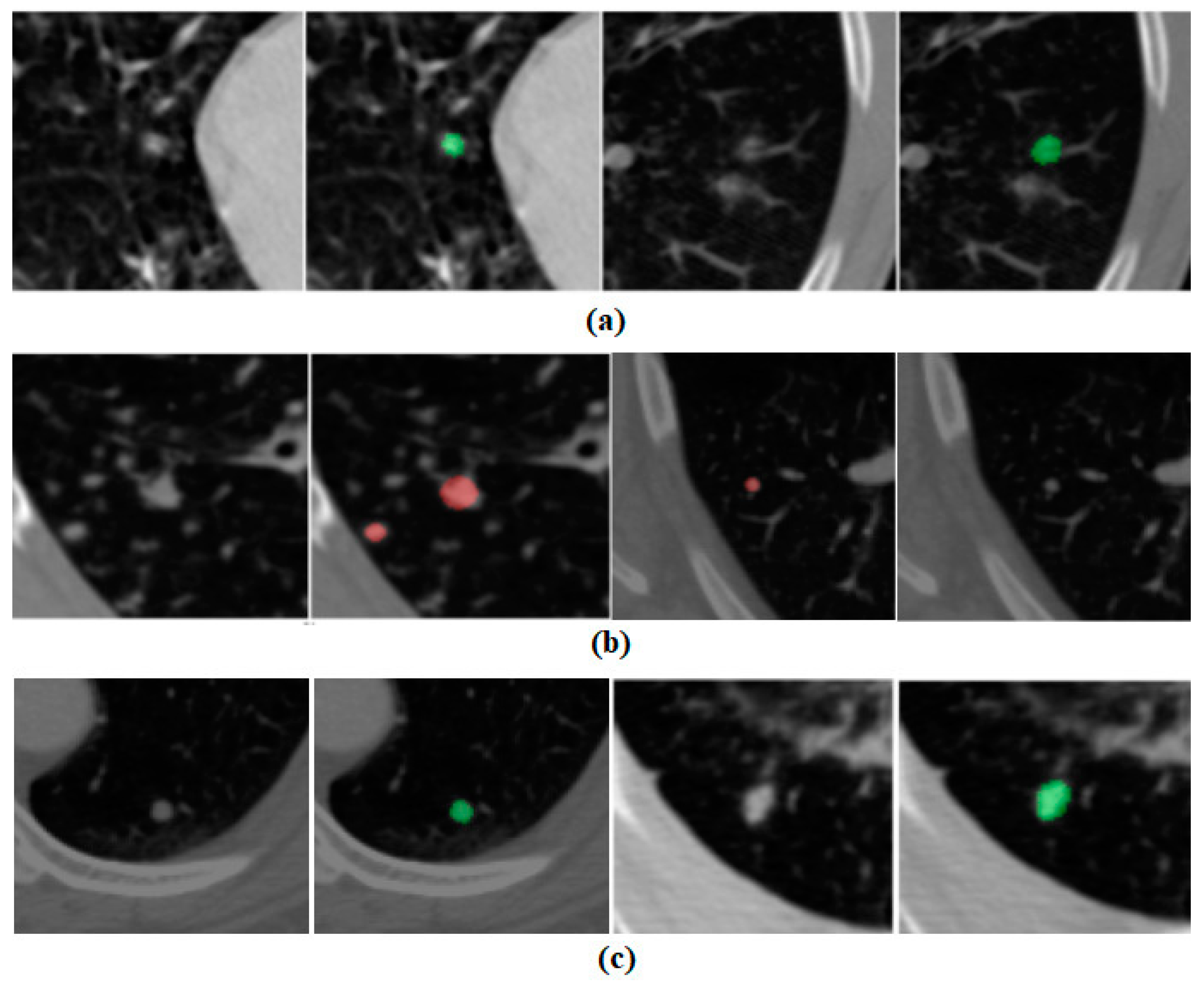 Curroncol 32 00095 g006