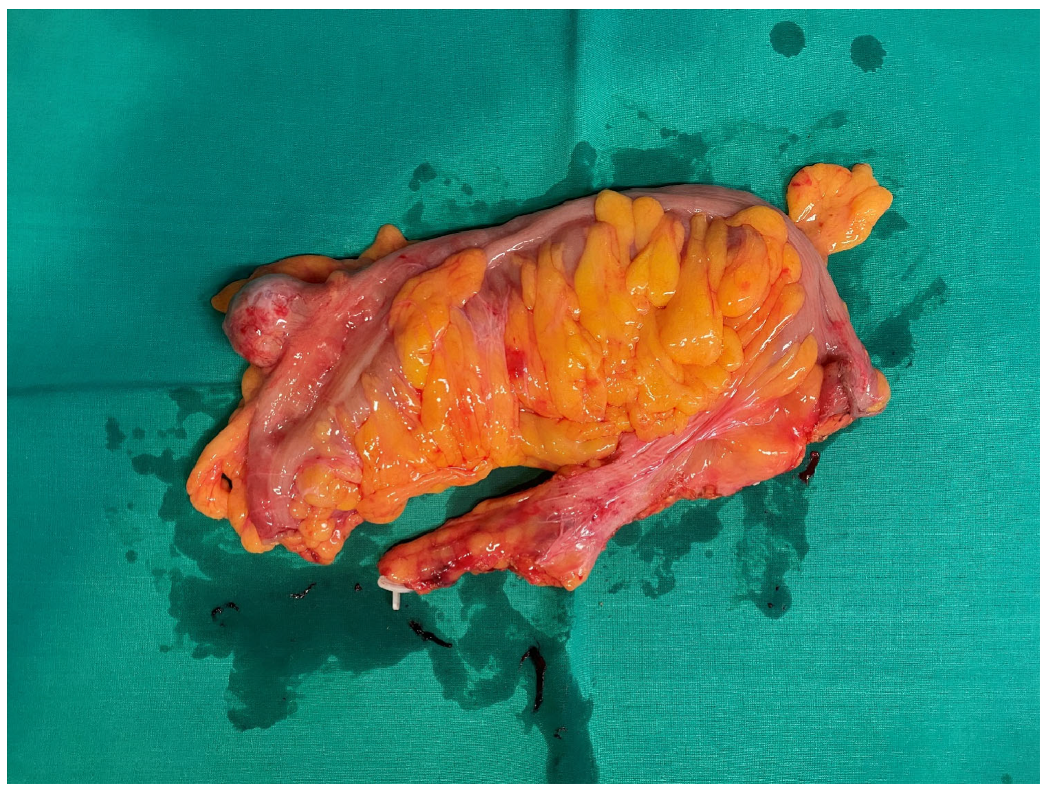 Curroncol 32 00330 g002