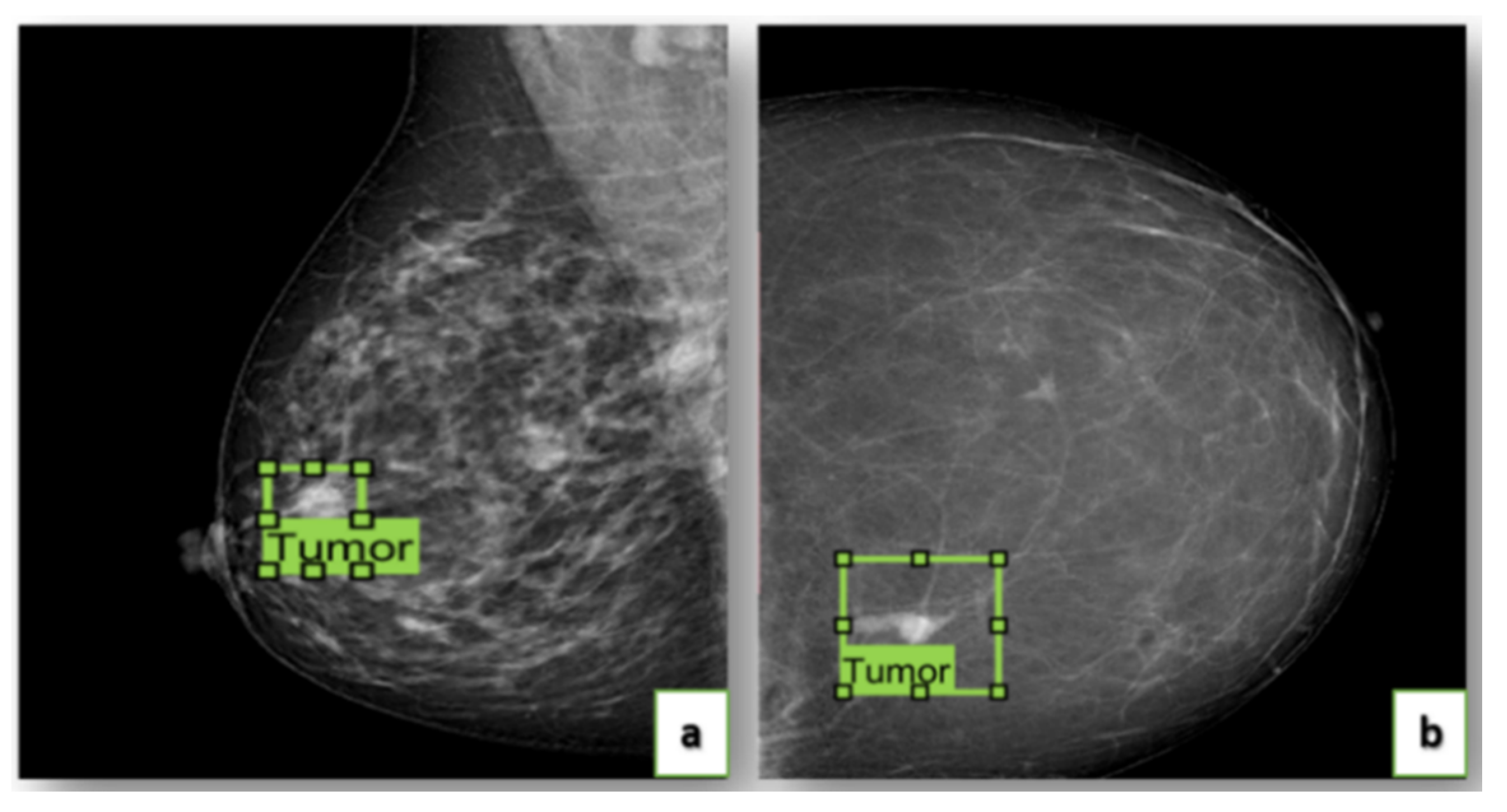 Data | Free Full-Text | King Abdulaziz University Breast Cancer ...