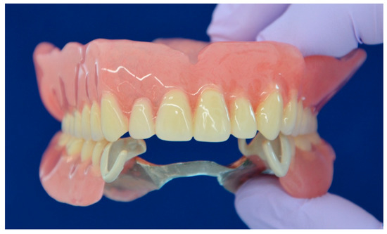intaglio surface dentistry
