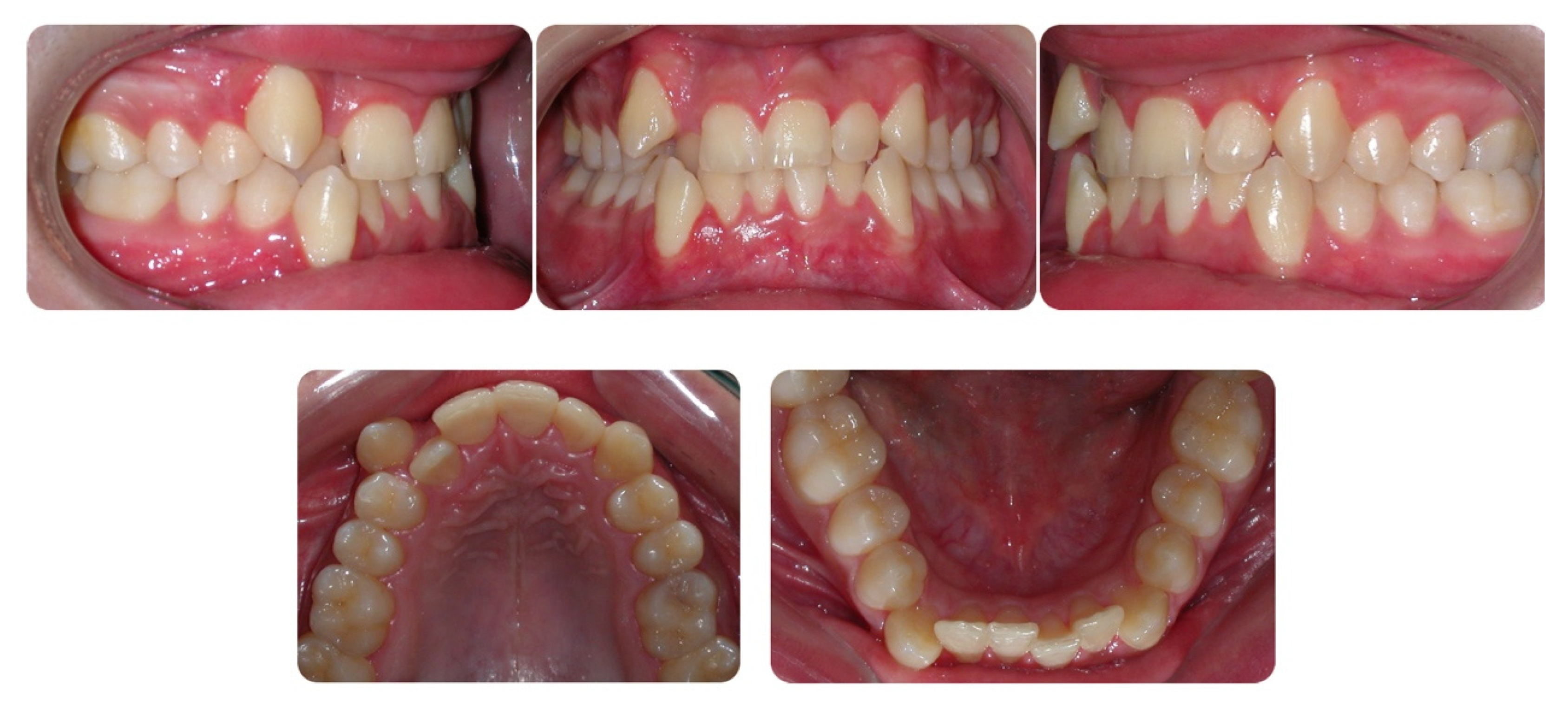 Dentistry 08 00041 g002 Dentistry 08 00041 g002