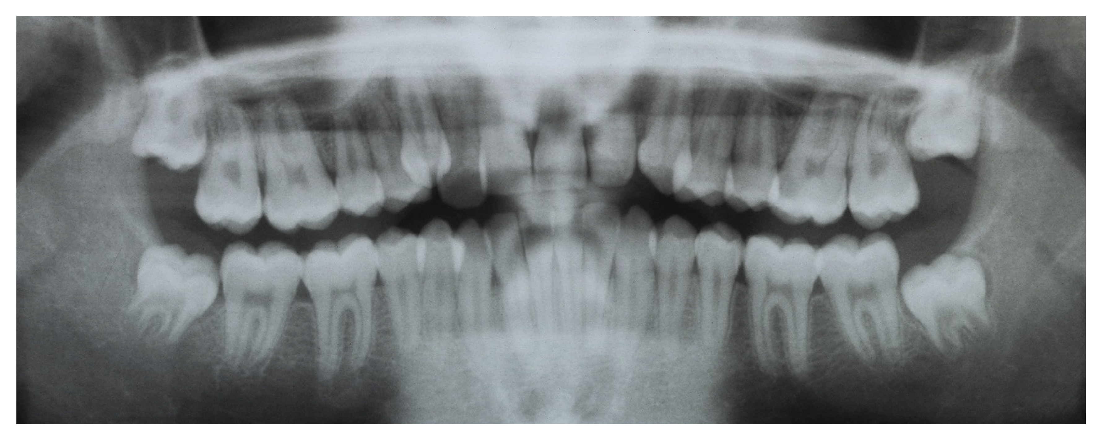 Dentistry 08 00041 g004 Dentistry 08 00041 g004