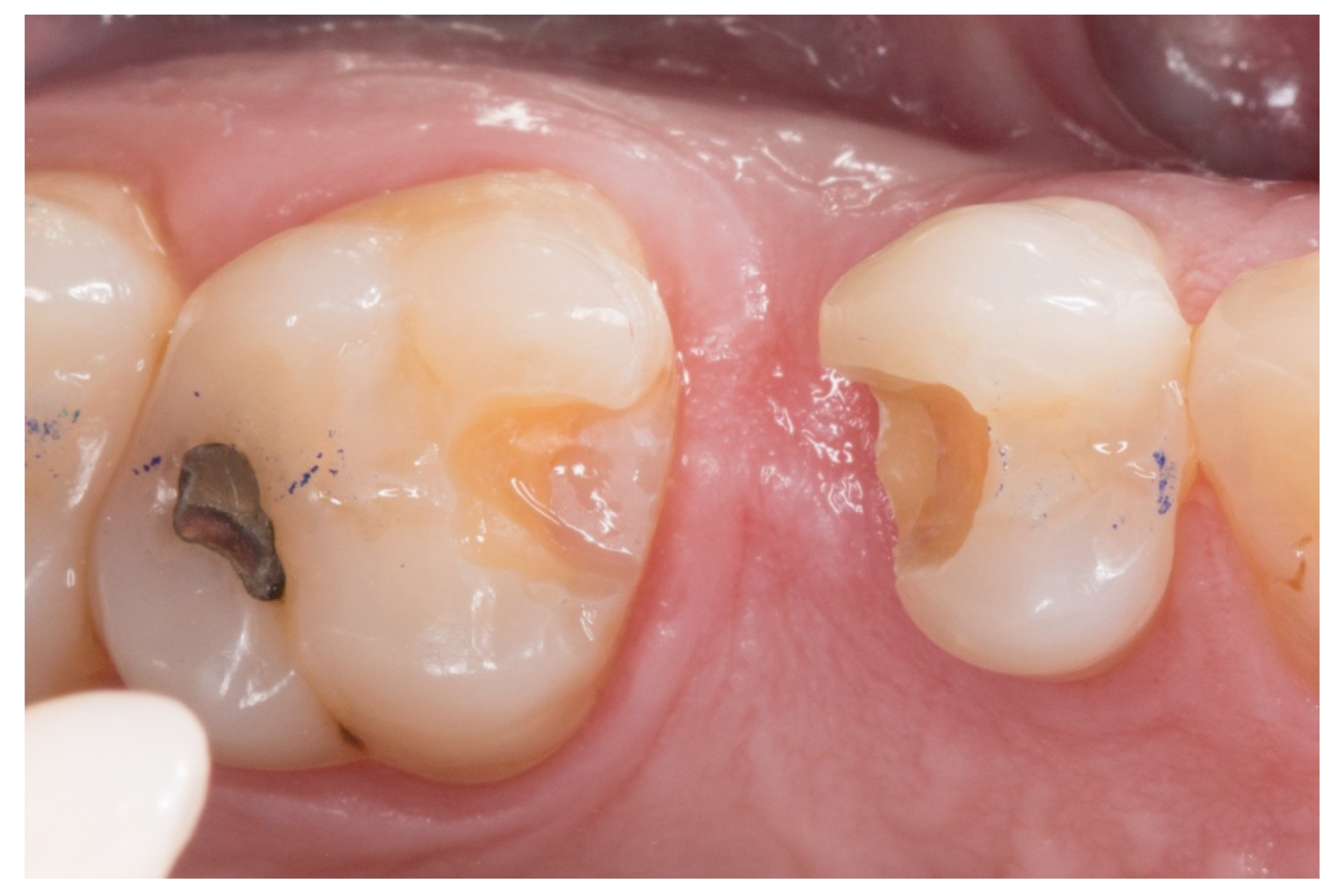 Dentistry 08 00048 g002 Dentistry 08 00048 g002