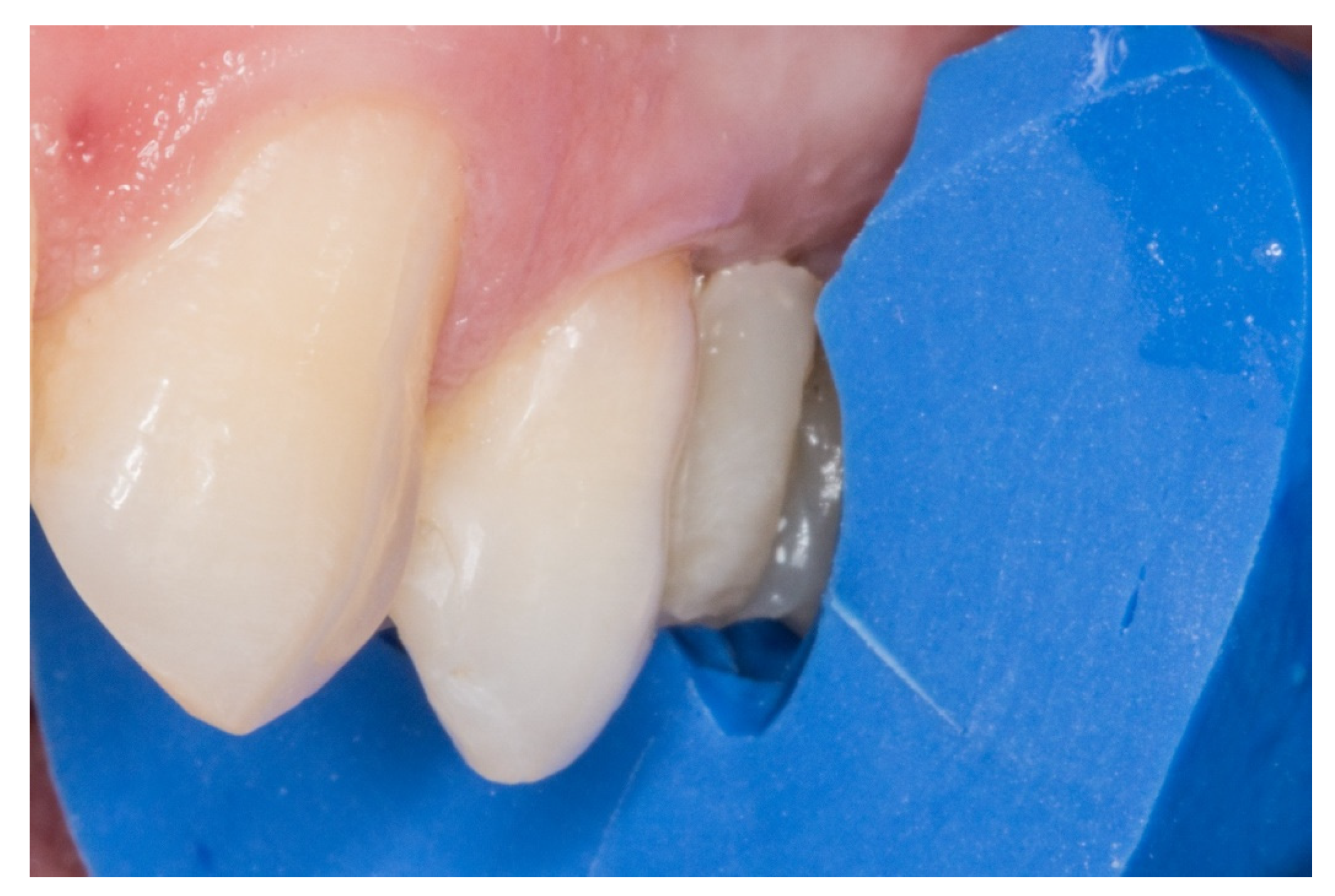 Dentistry 08 00048 g006 Dentistry 08 00048 g006