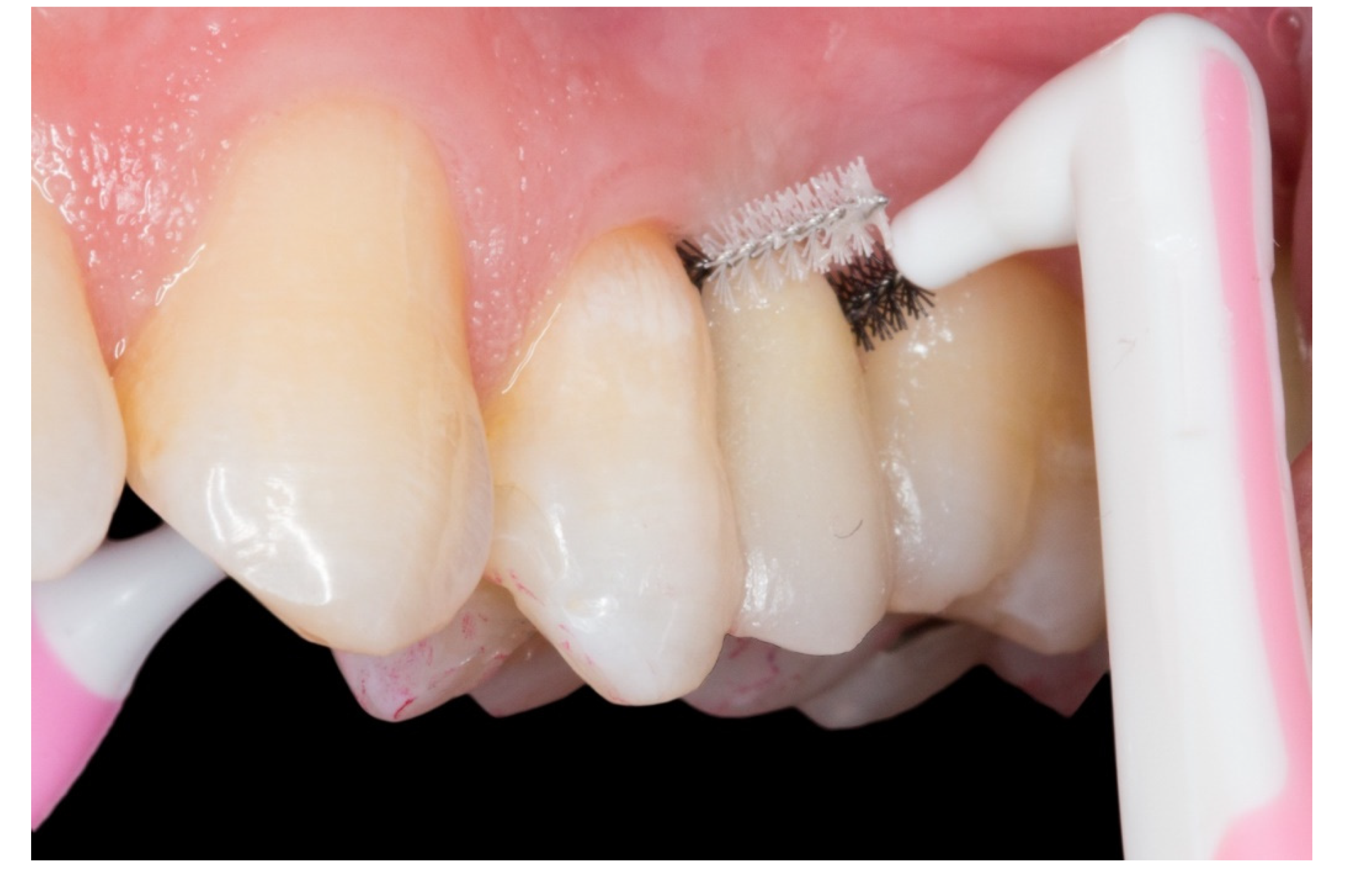 Dentistry 08 00048 g008 Dentistry 08 00048 g008