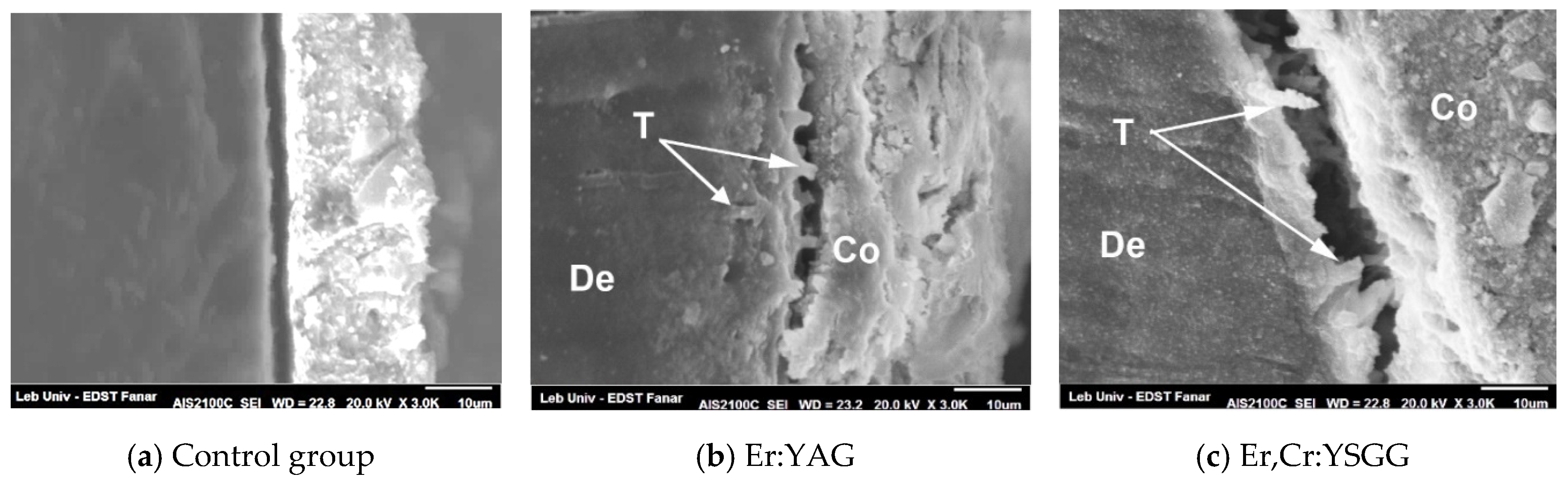Dentistry Journal | Free Full-Text | Comparison between Shear Bond Strength  of Er:YAG and Er,Cr:YSGG Lasers-Assisted Dentinal Adhesion of Self-Adhering  Resin Composite: An Ex Vivo Study