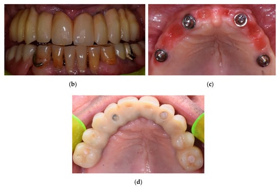 Dentistry Journal September 2020 - Browse Articles