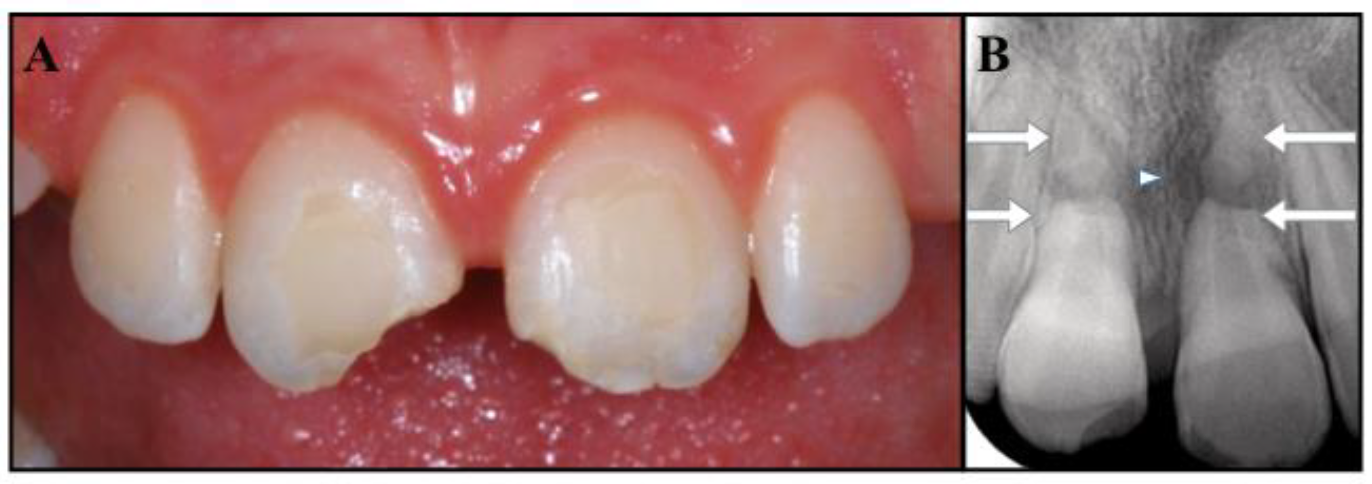 Dentistry Journal, Free Full-Text