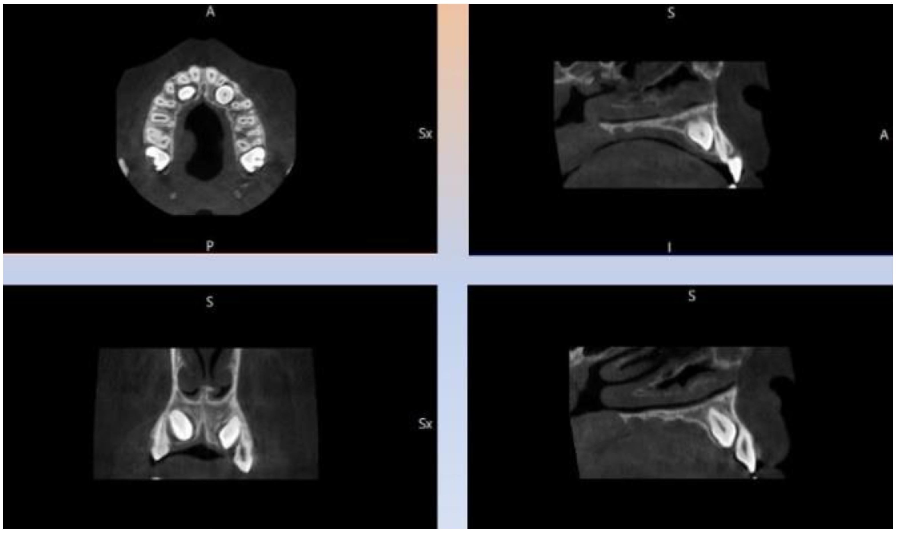 Dentistry 09 00066 g002 Dentistry 09 00066 g002