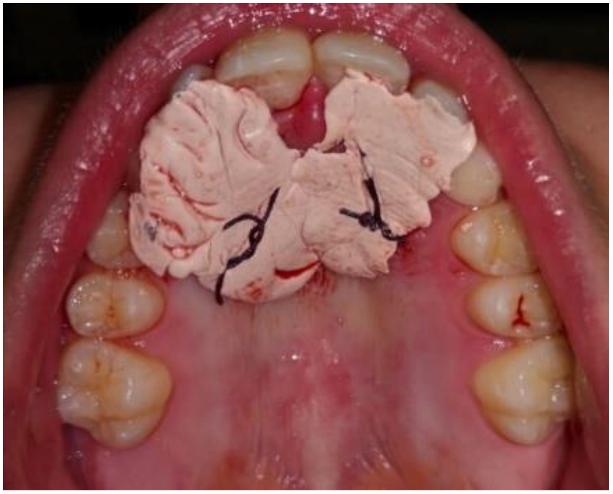 Dentistry 09 00066 g004 Dentistry 09 00066 g004