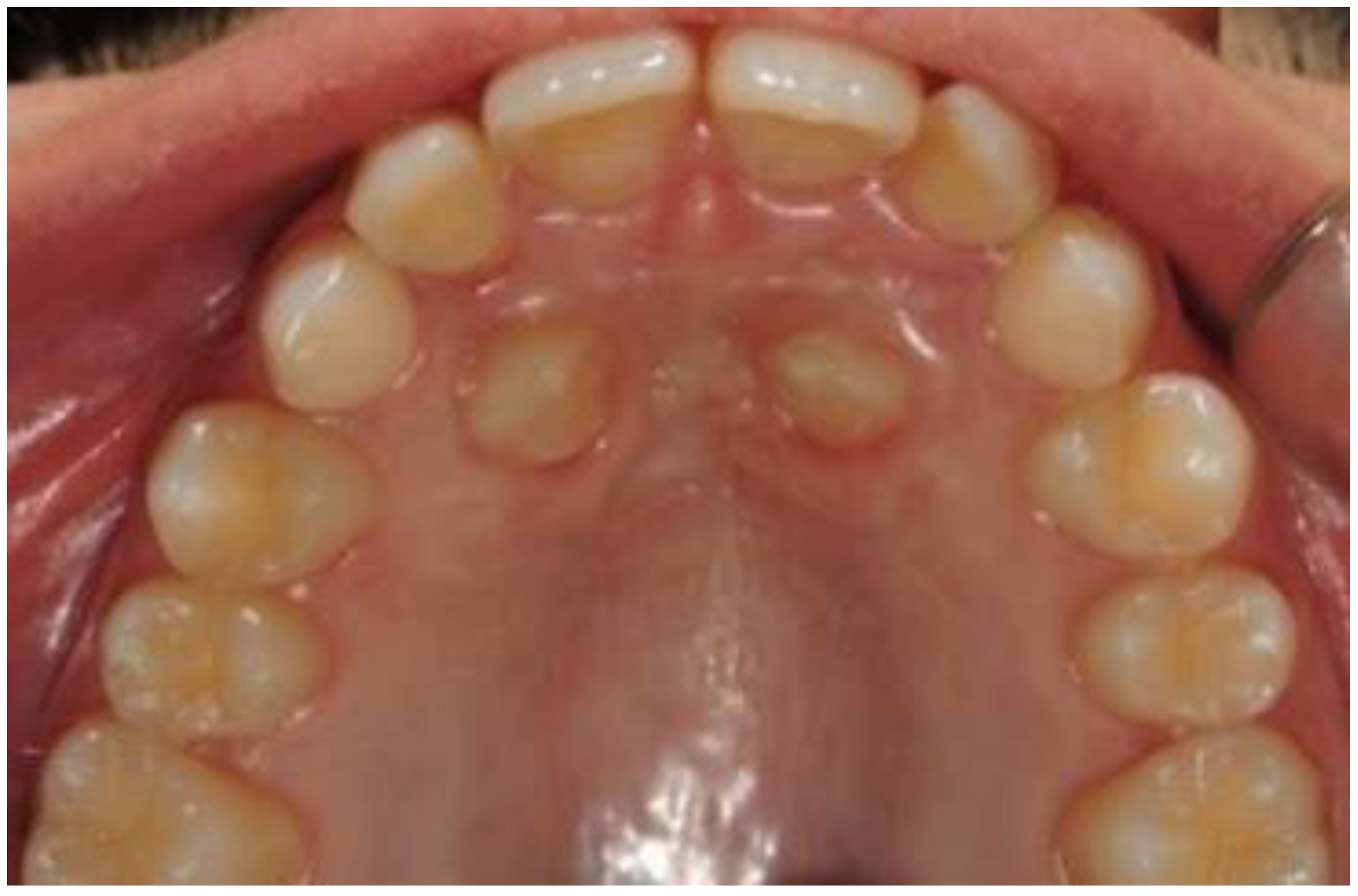 Dentistry 09 00066 g006 Dentistry 09 00066 g006