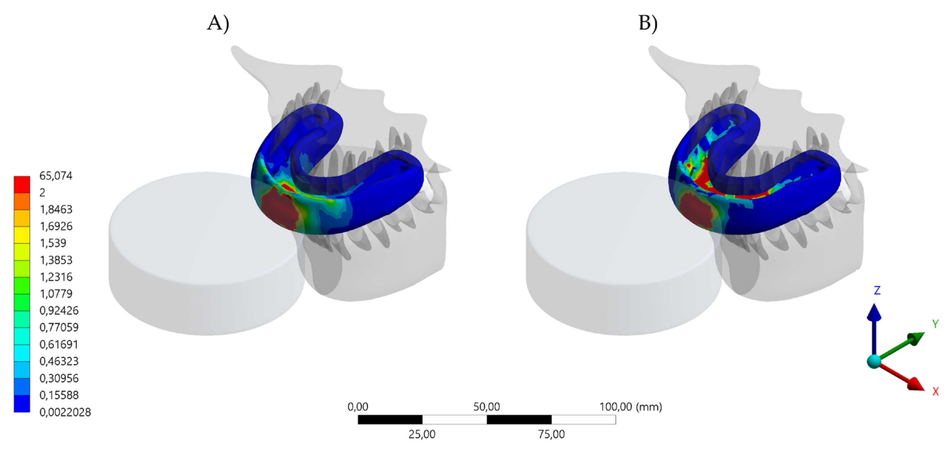 Dentistry 10 00065 g005 Dentistry 10 00065 g005