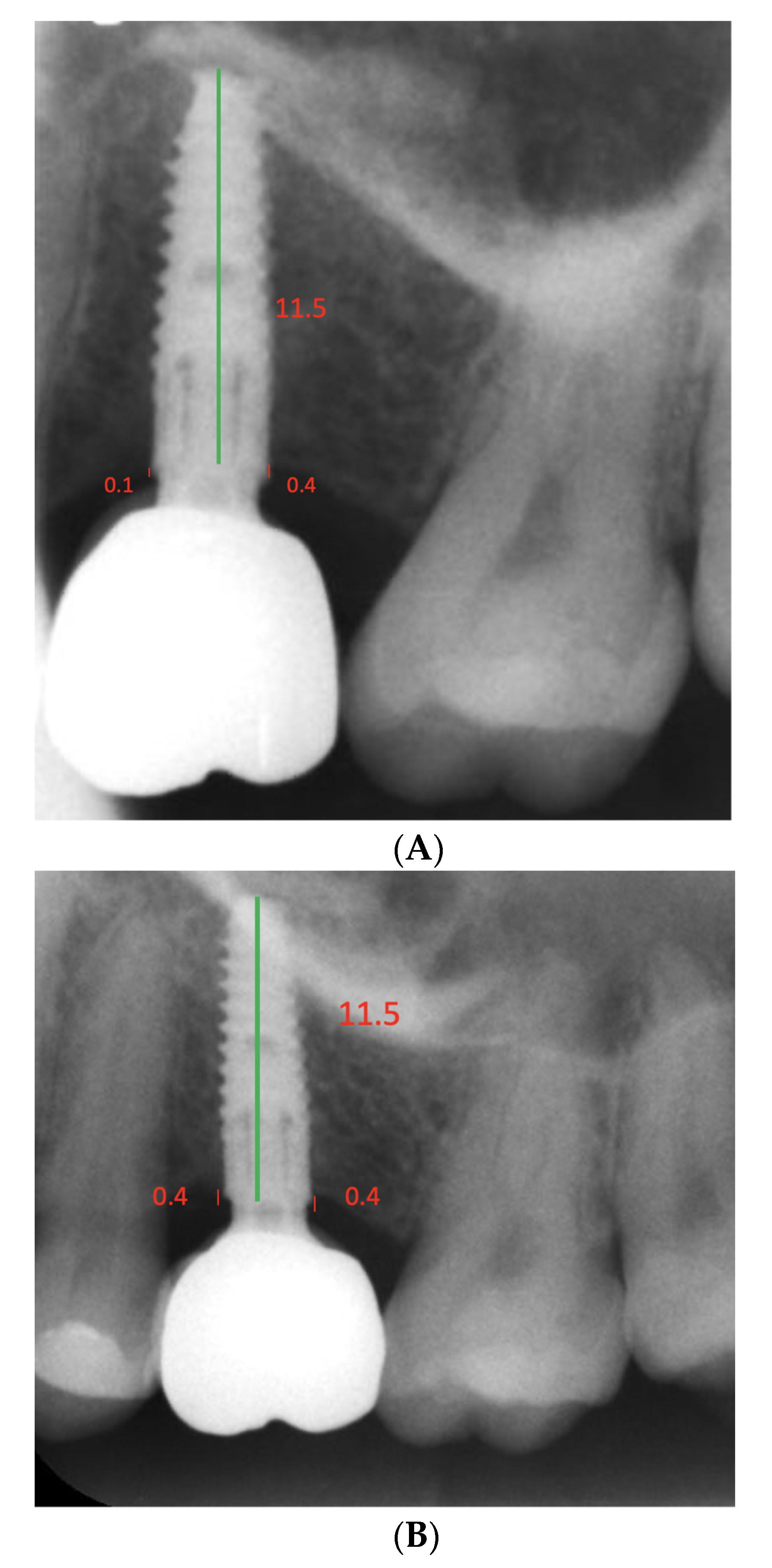 Dentistry 10 00113 g004 Dentistry 10 00113 g004