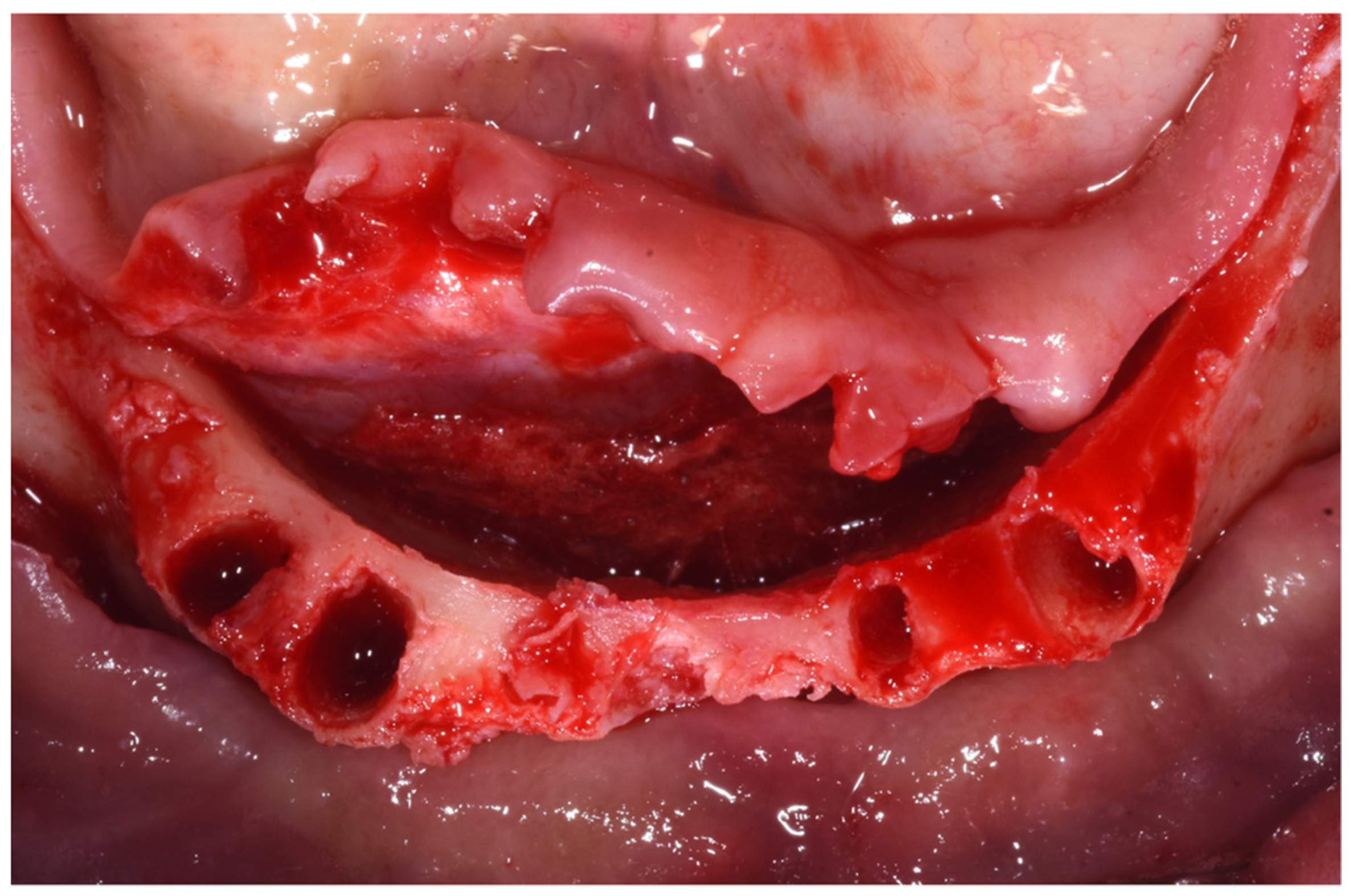 Dentistry 10 00116 g004