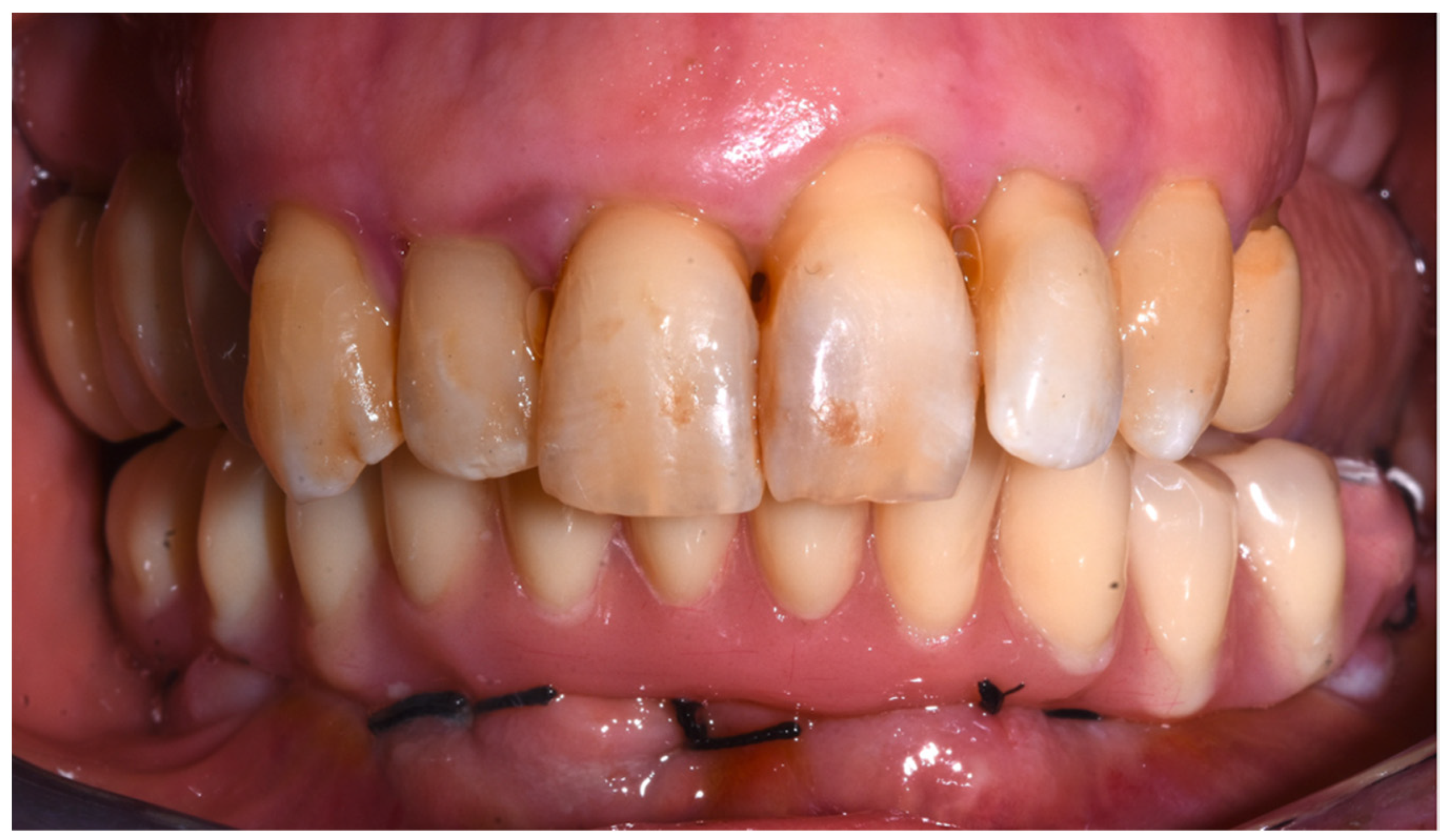 Dentistry 10 00116 g008