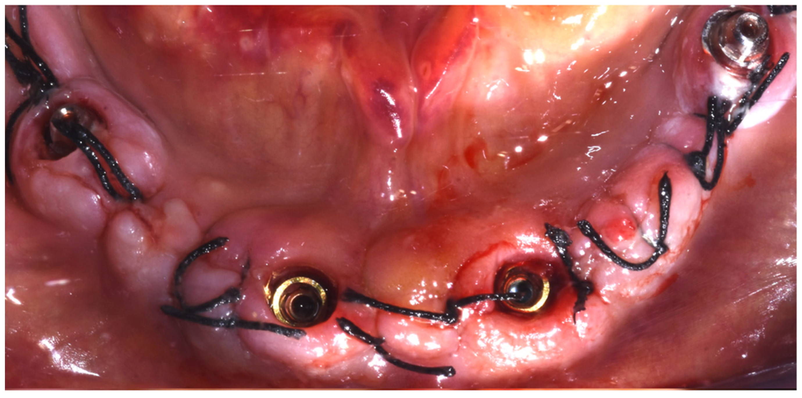 Dentistry 10 00116 g010