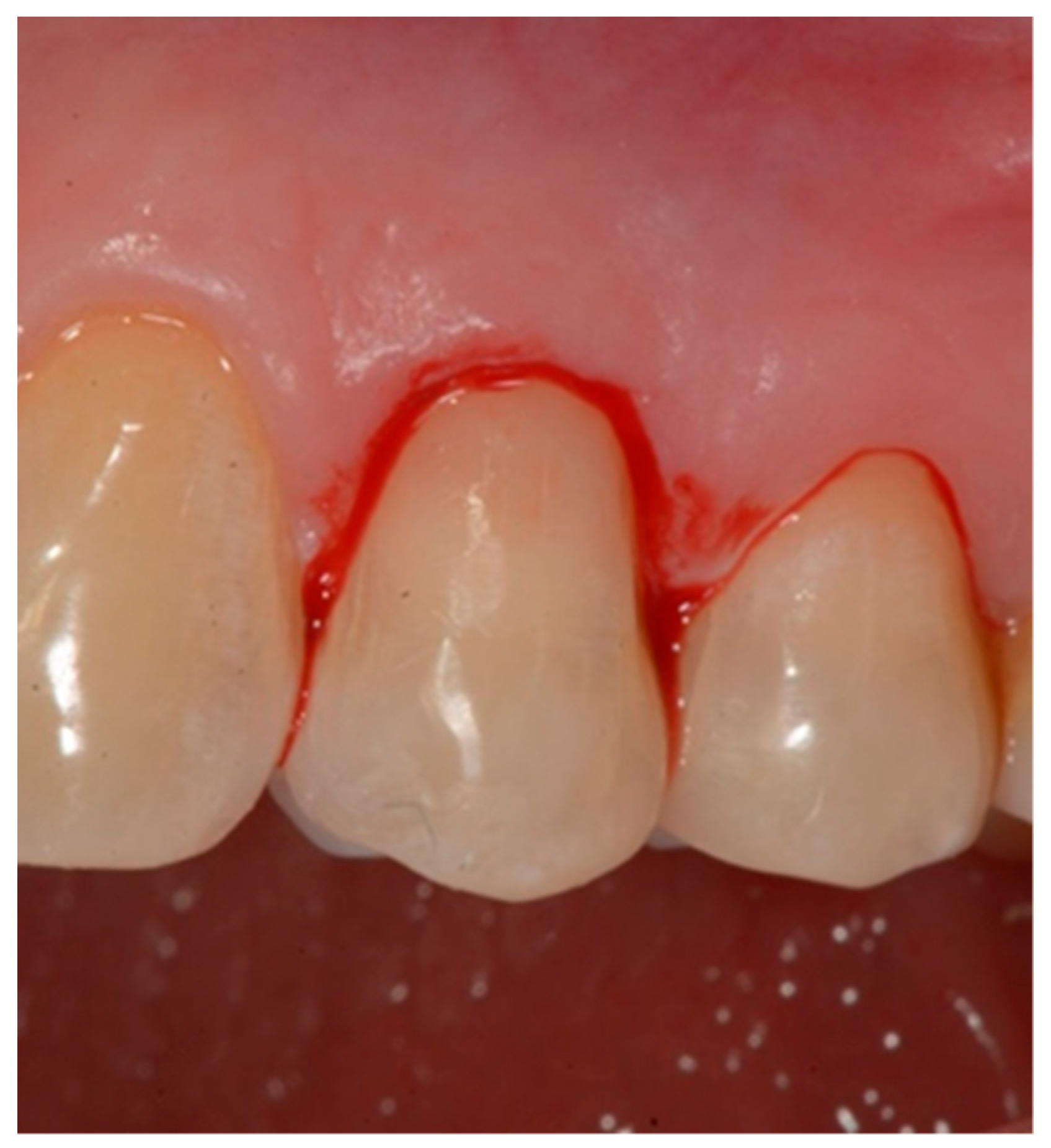 Dentistry 10 00132 g009 Dentistry 10 00132 g009