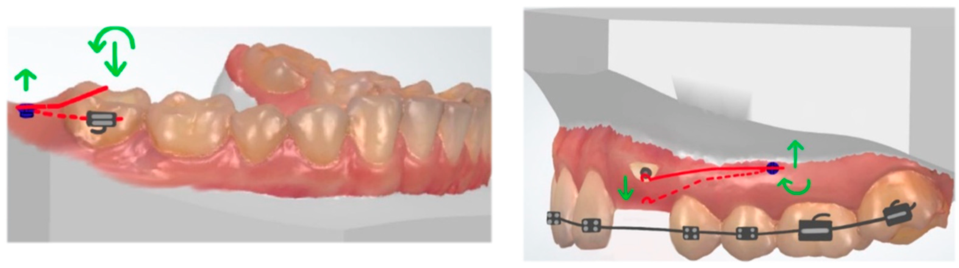 Dentistry 10 00135 g003 Dentistry 10 00135 g003